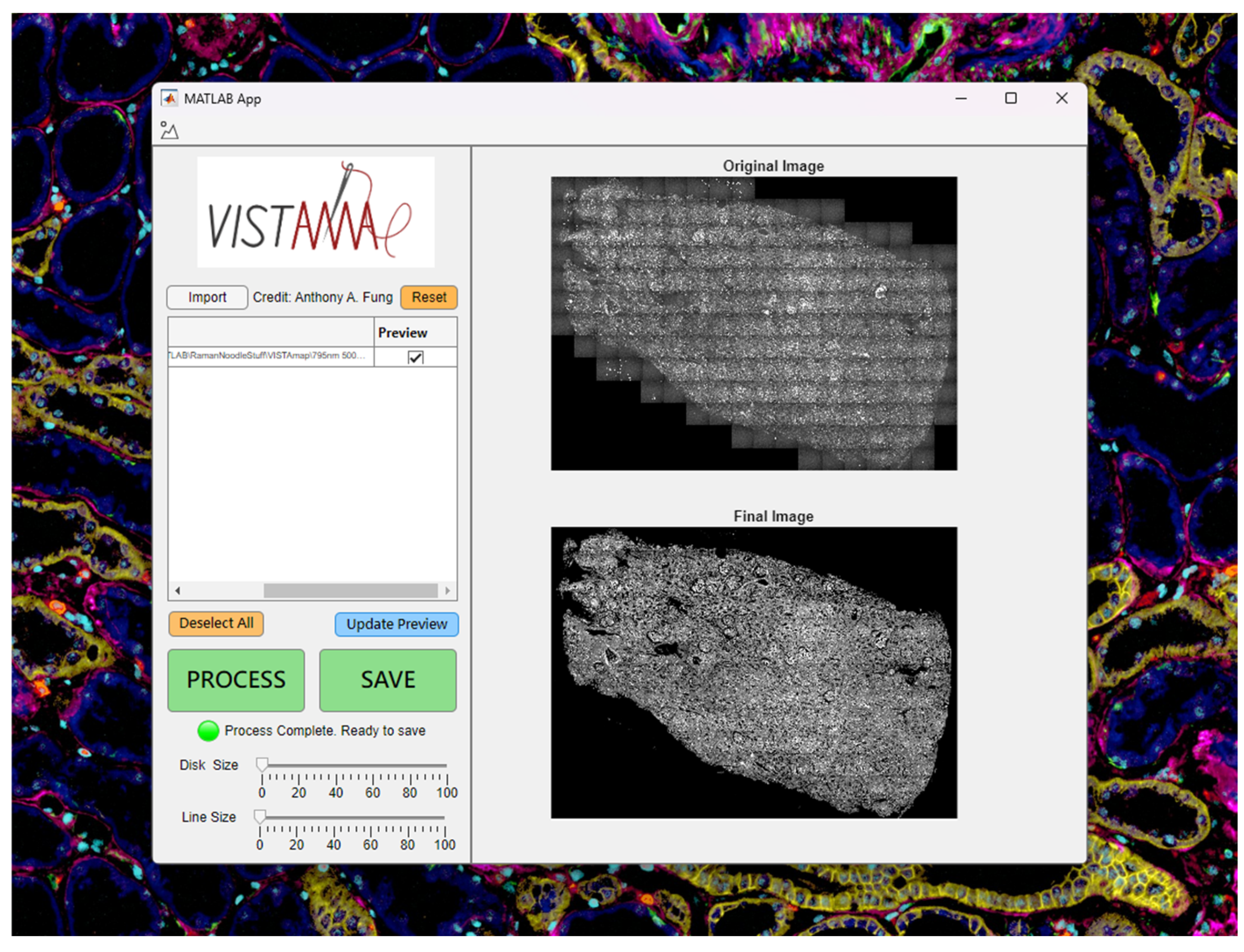 Single-Frame Vignetting Correction for Post-Stitched-Tile Imaging
