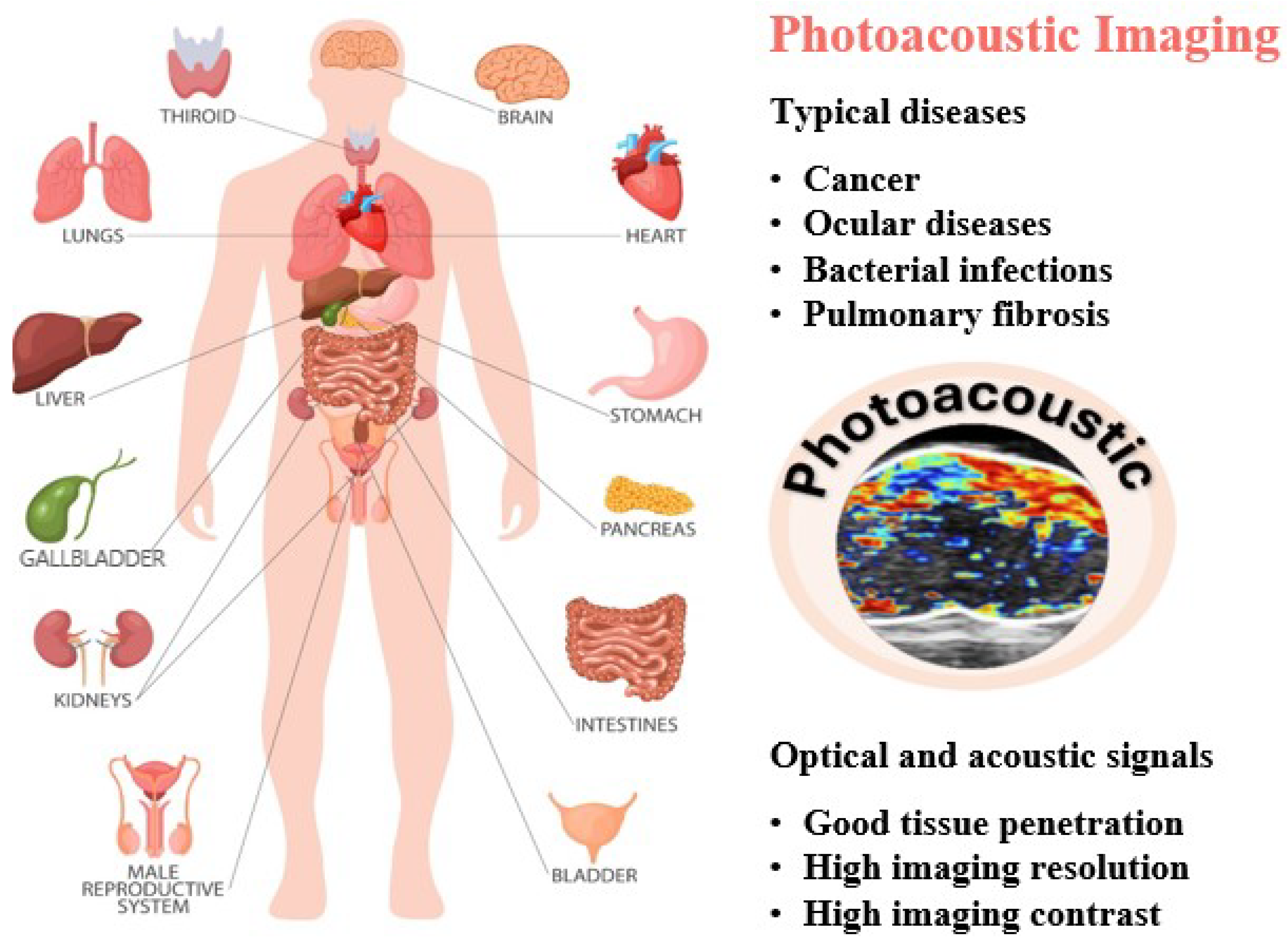 Nanomaterials 15 01074 g002