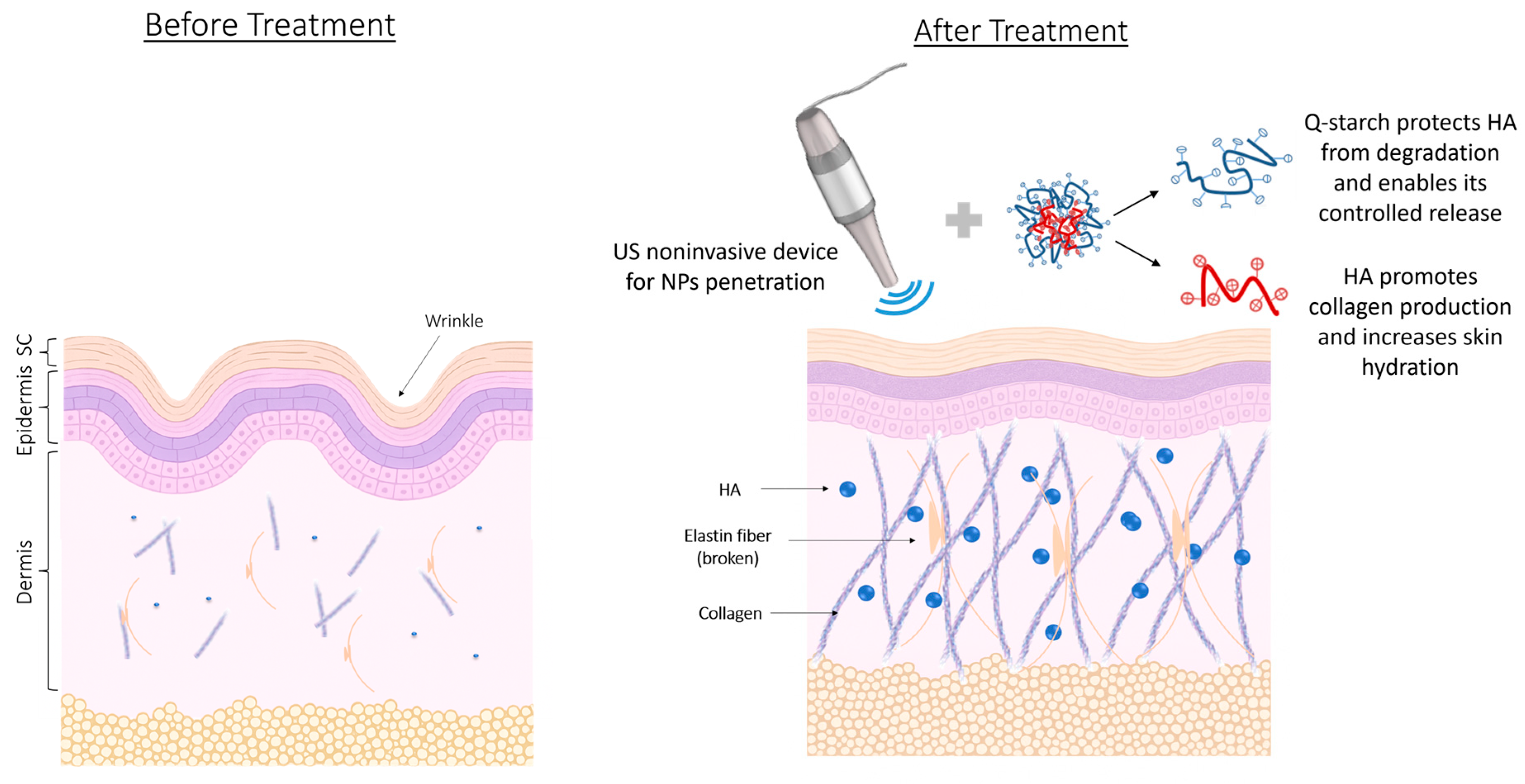 Nanomaterials 15 01739 g010