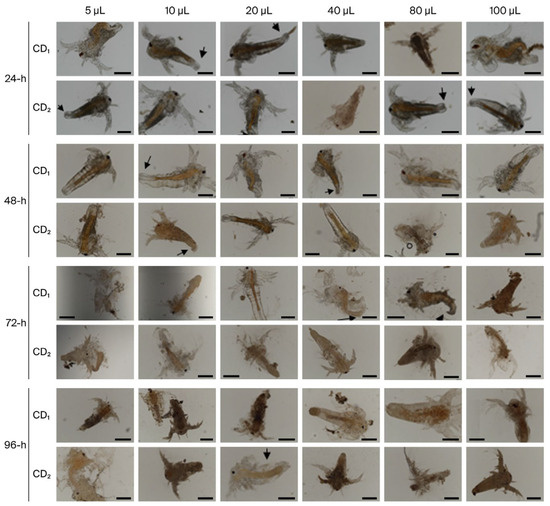l carnitine negatives L-carnitine: new perspectives on the management of preterm infants Role of Carnitine in Non-alcoholic