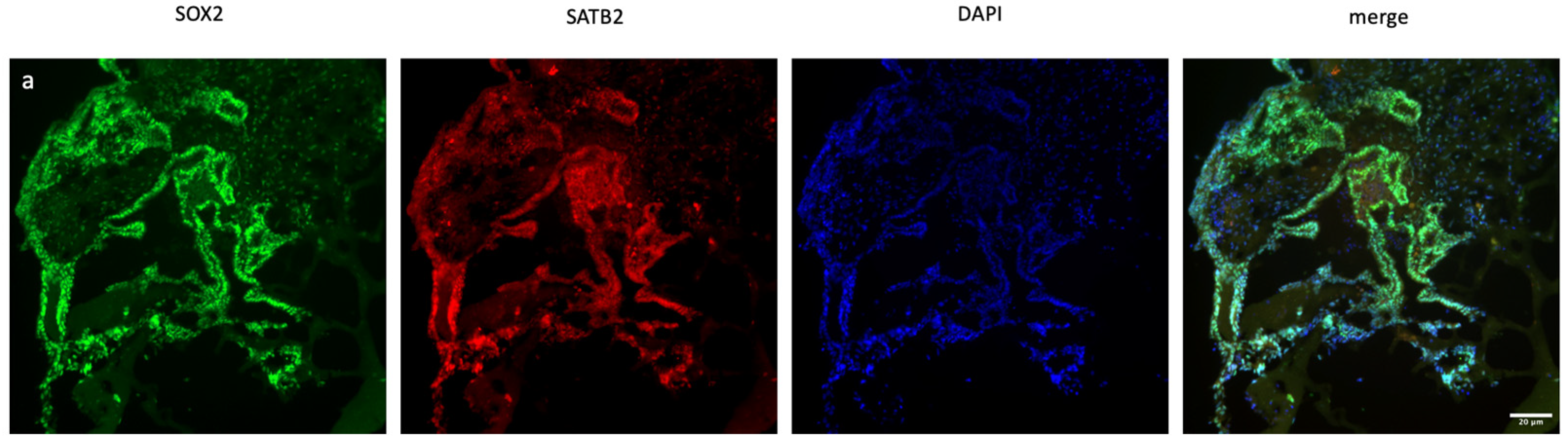 Ncrna 11 00031 g002a