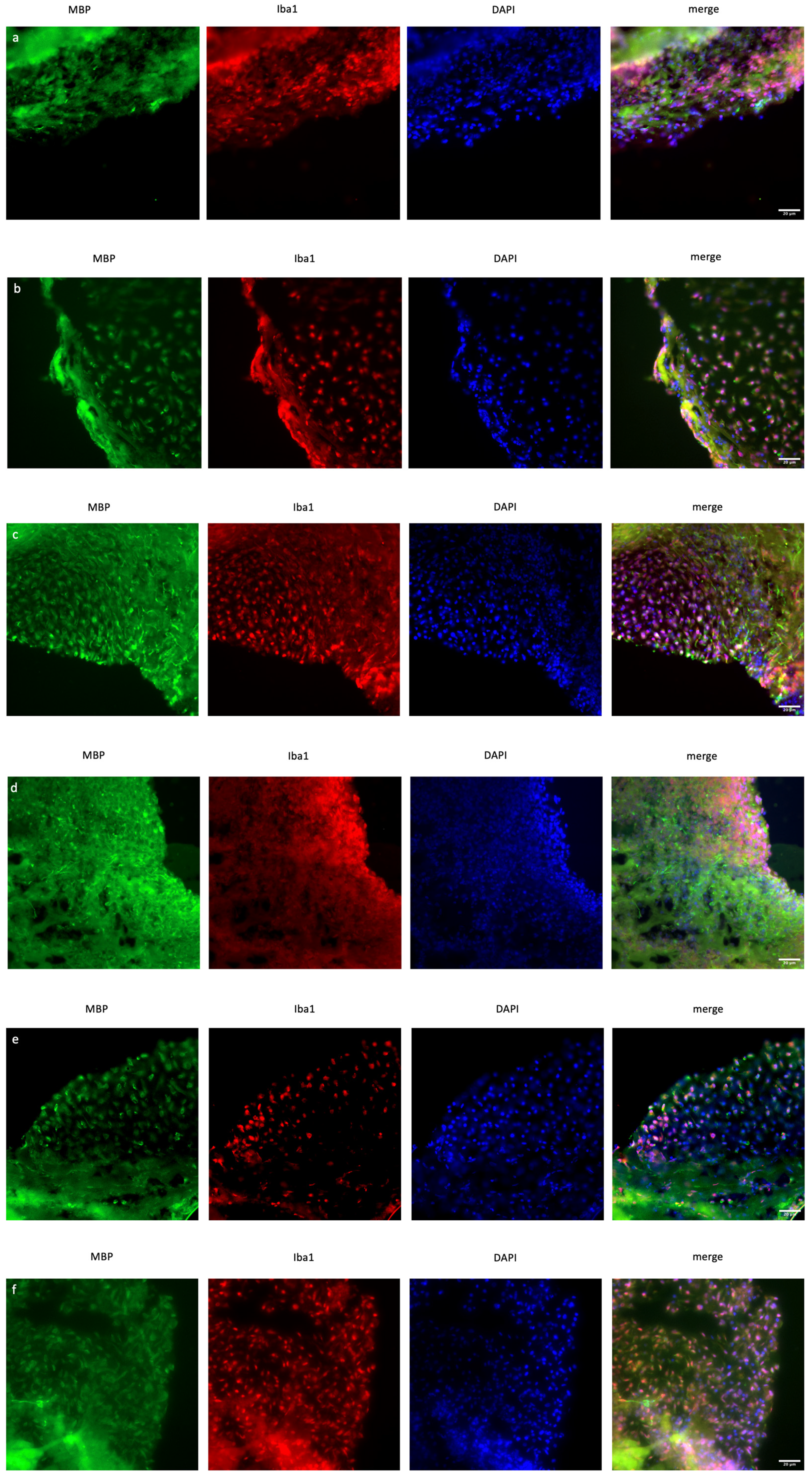 Ncrna 11 00031 g004a