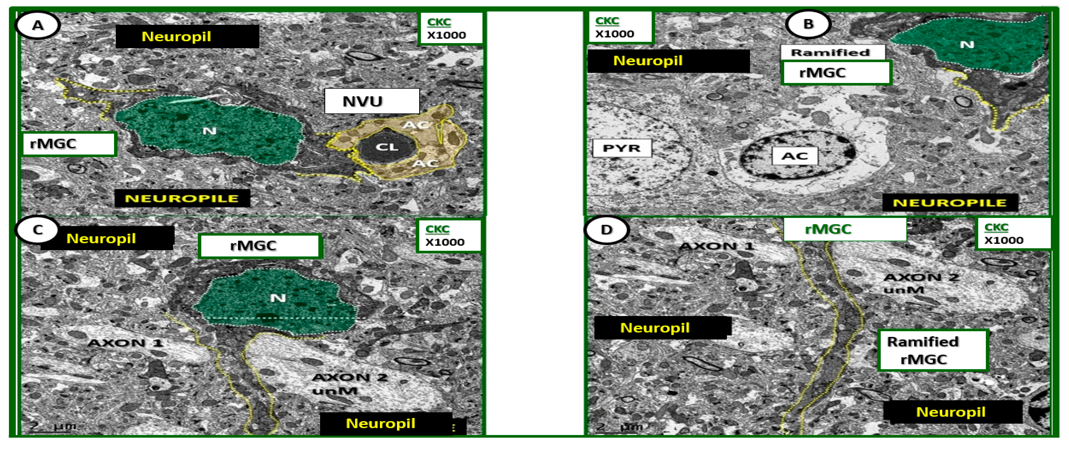 Neuroglia 01 00021 g004