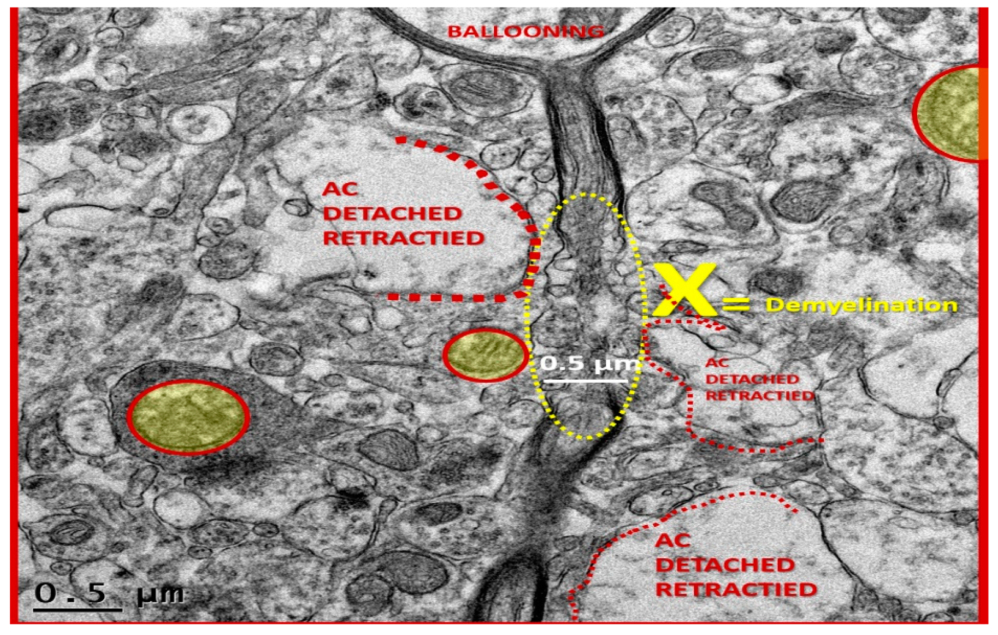 Neuroglia 01 00024 g014