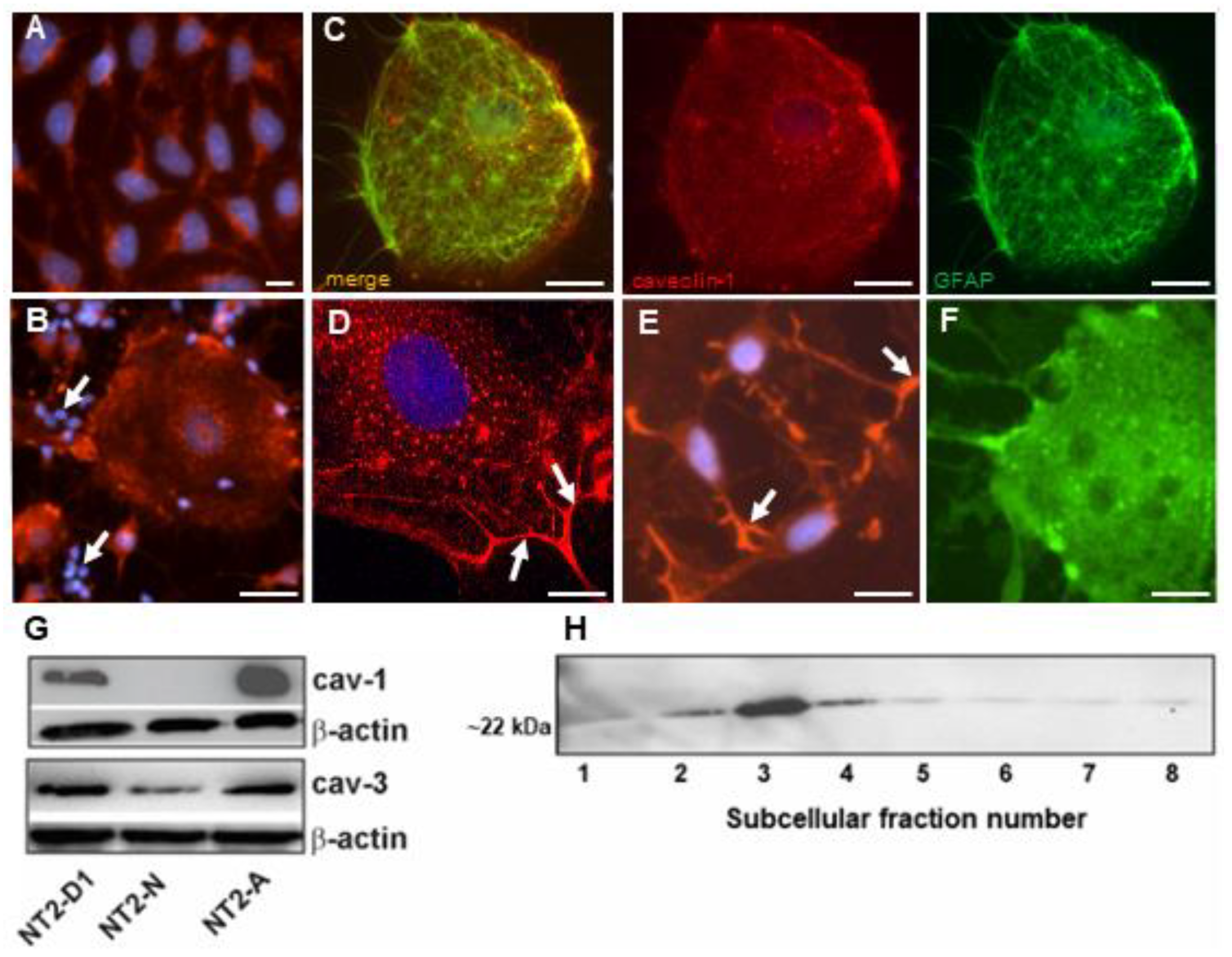 Neuroglia 02 00008 g003 Neuroglia 02 00008 g003