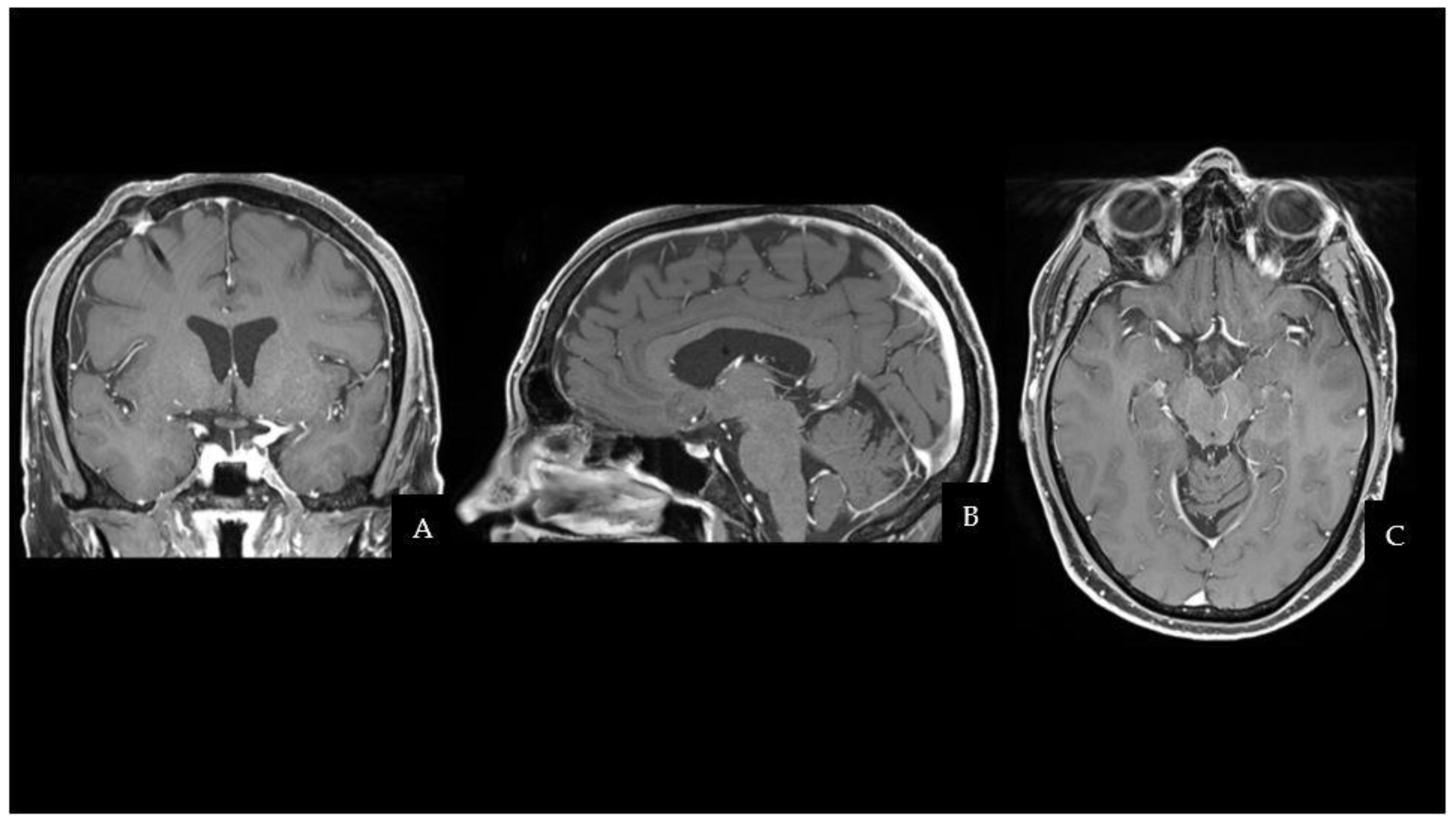 Neuroglia 05 00004 g002