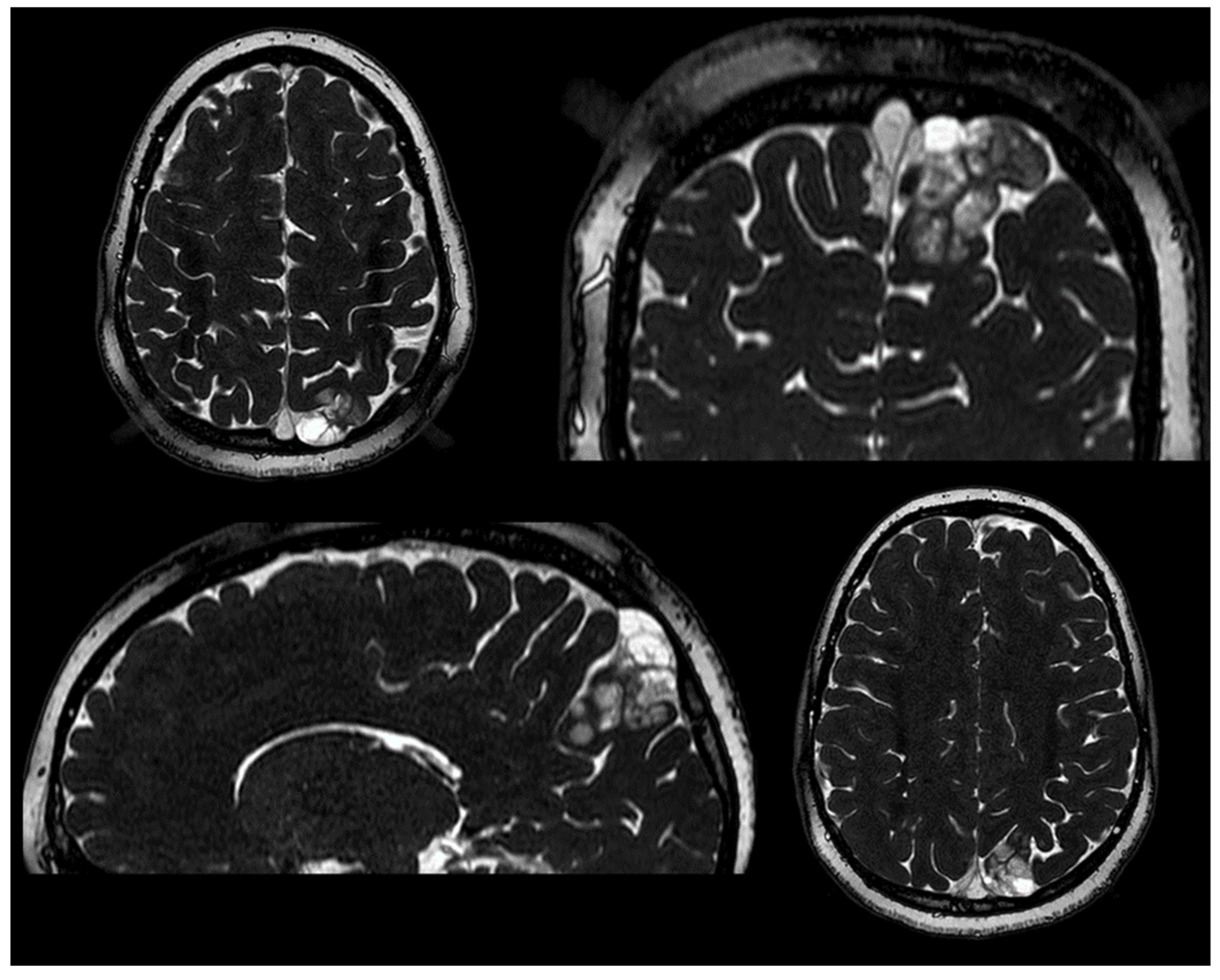 Neuroglia 05 00013 g001