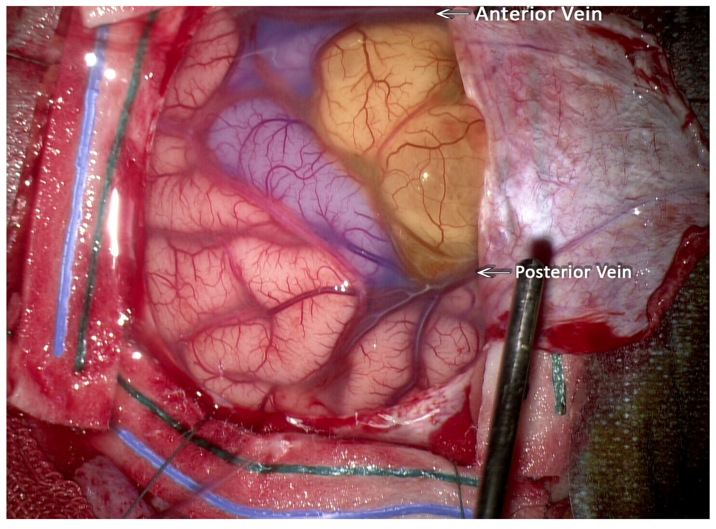 Neuroglia 05 00013 g003