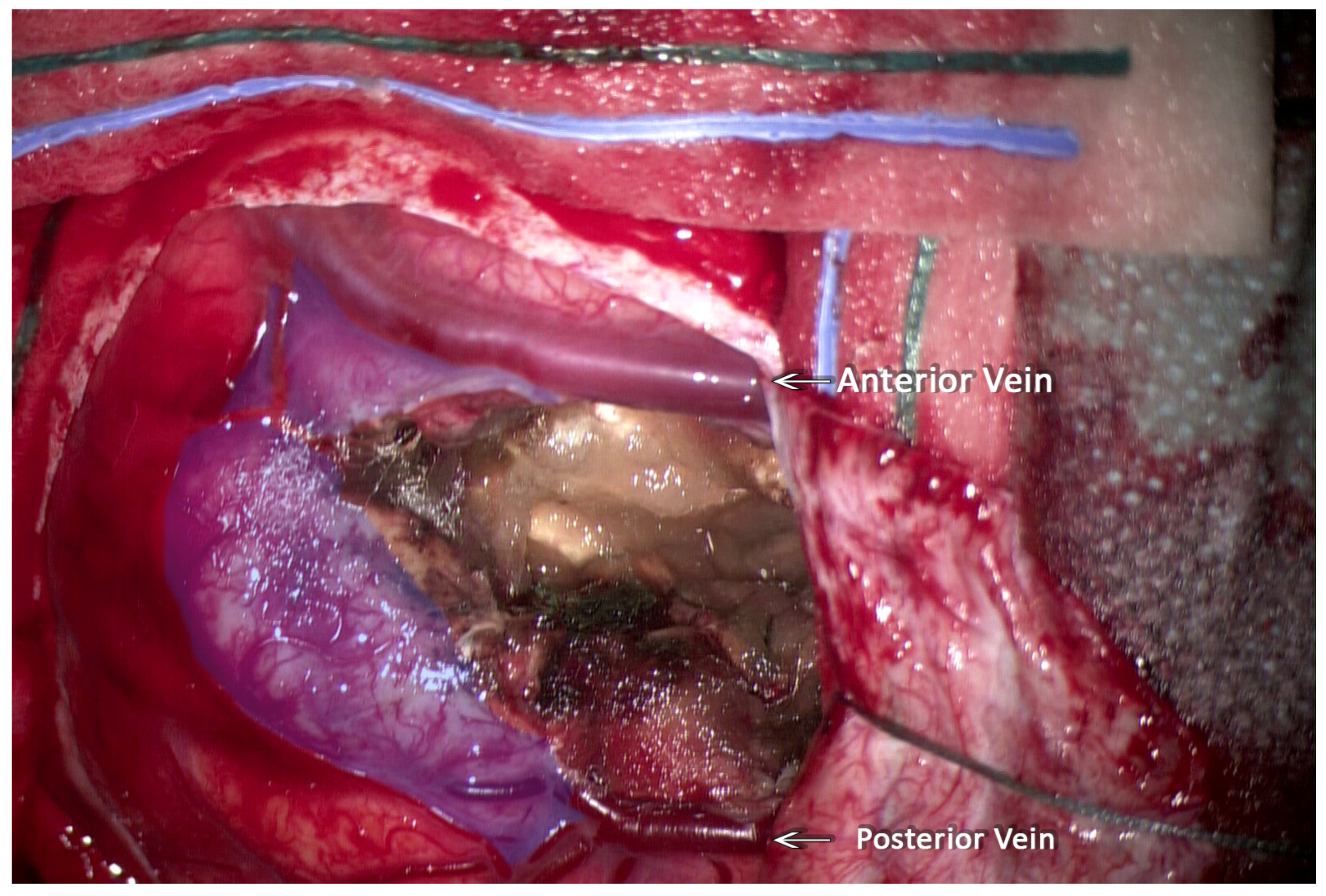 Neuroglia 05 00013 g004