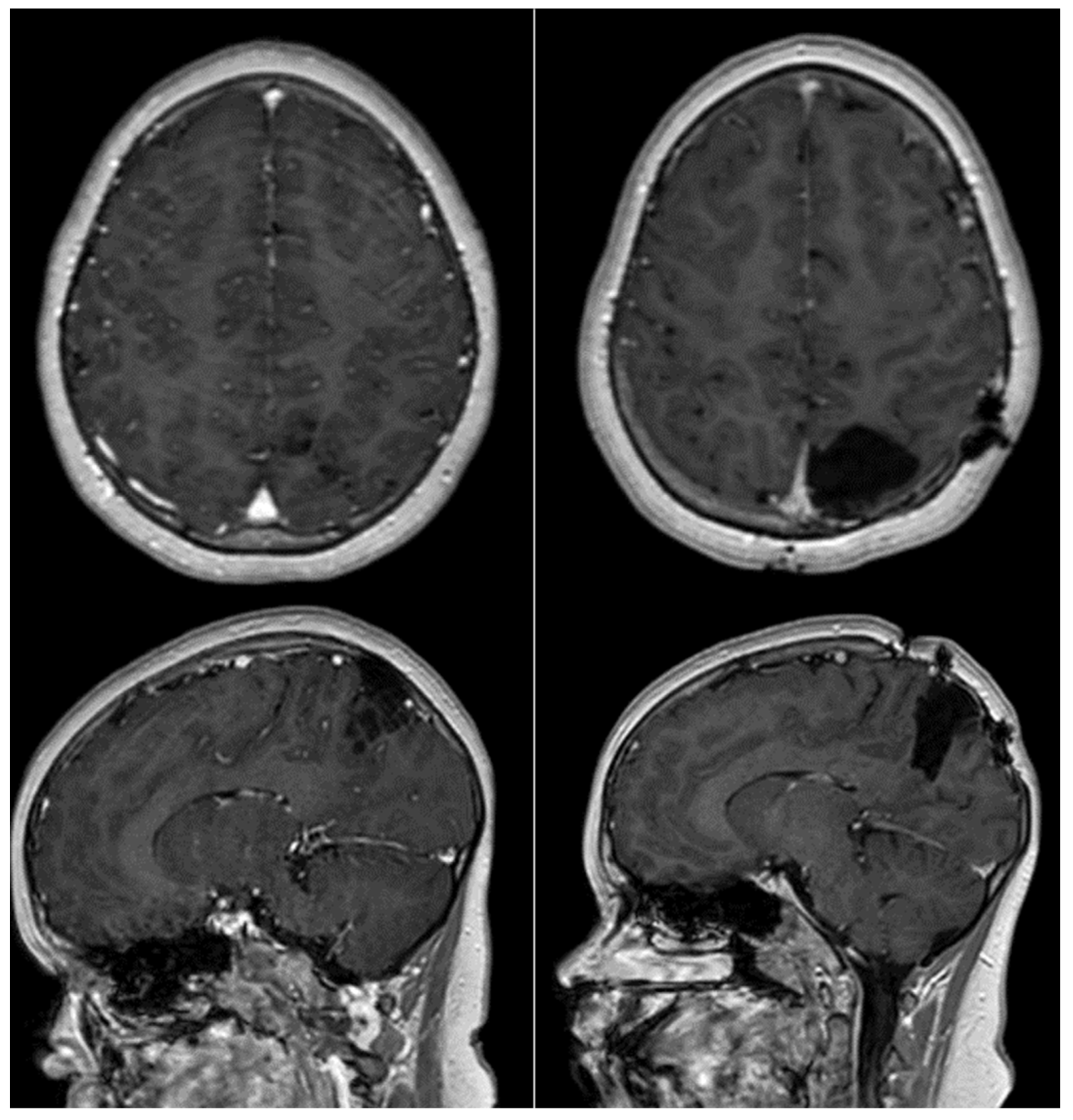 Neuroglia 05 00013 g005