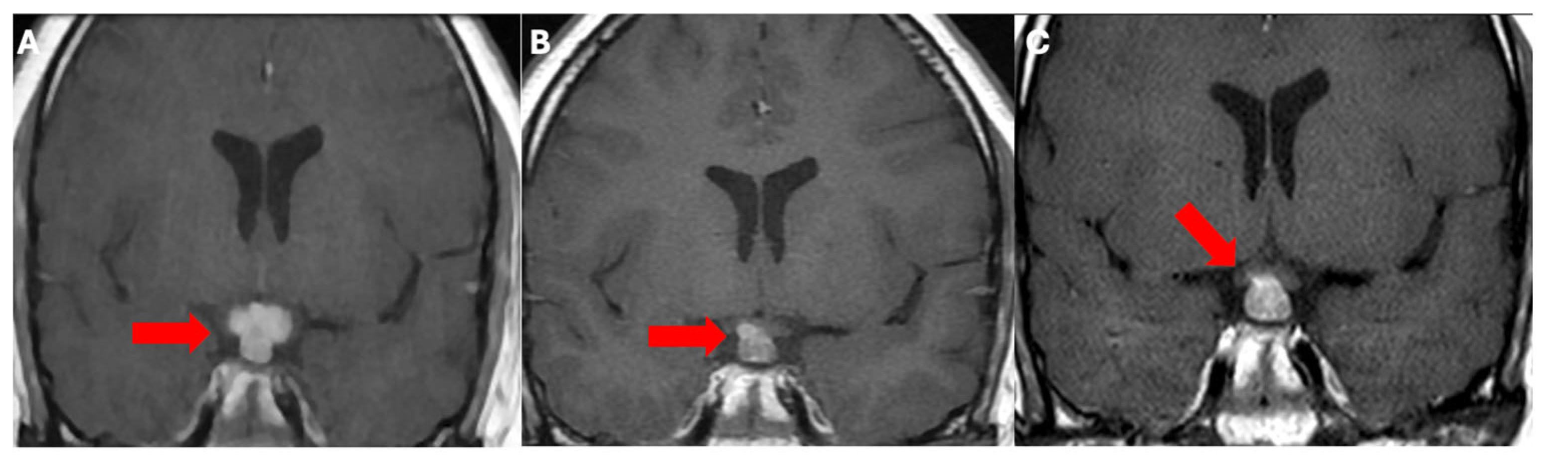 Neuroimaging 01 00004 g002 Neuroimaging 01 00004 g002
