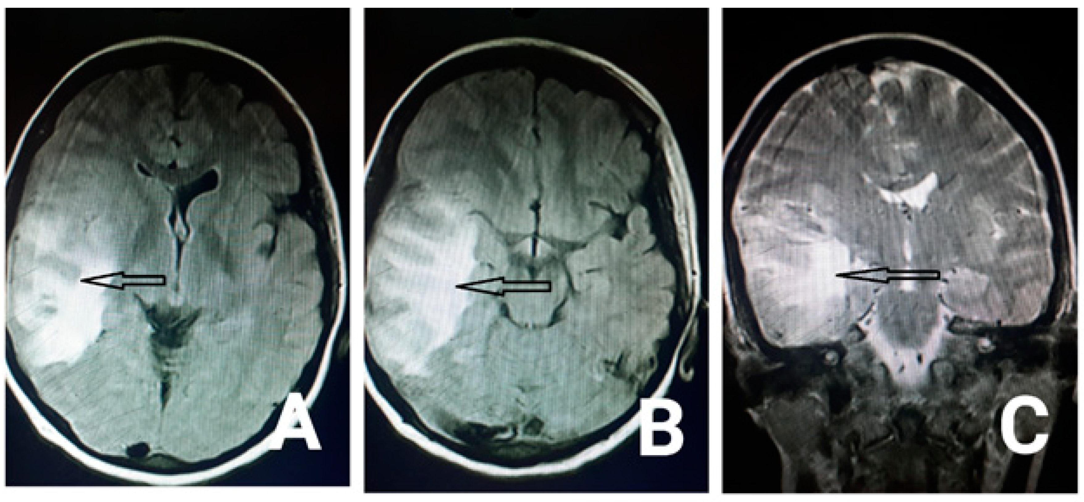 Neurolint 13 00011 g002