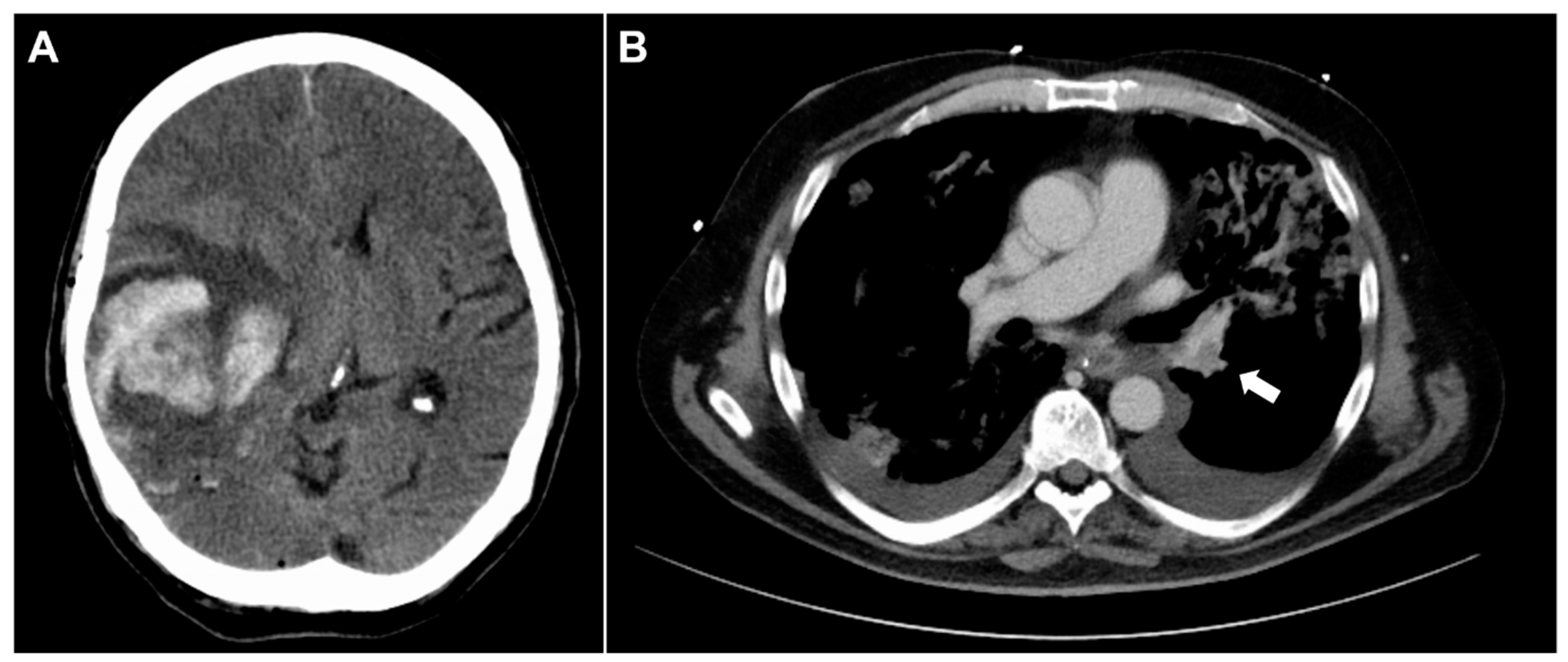 Neurolint 13 00021 g001 Neurolint 13 00021 g001