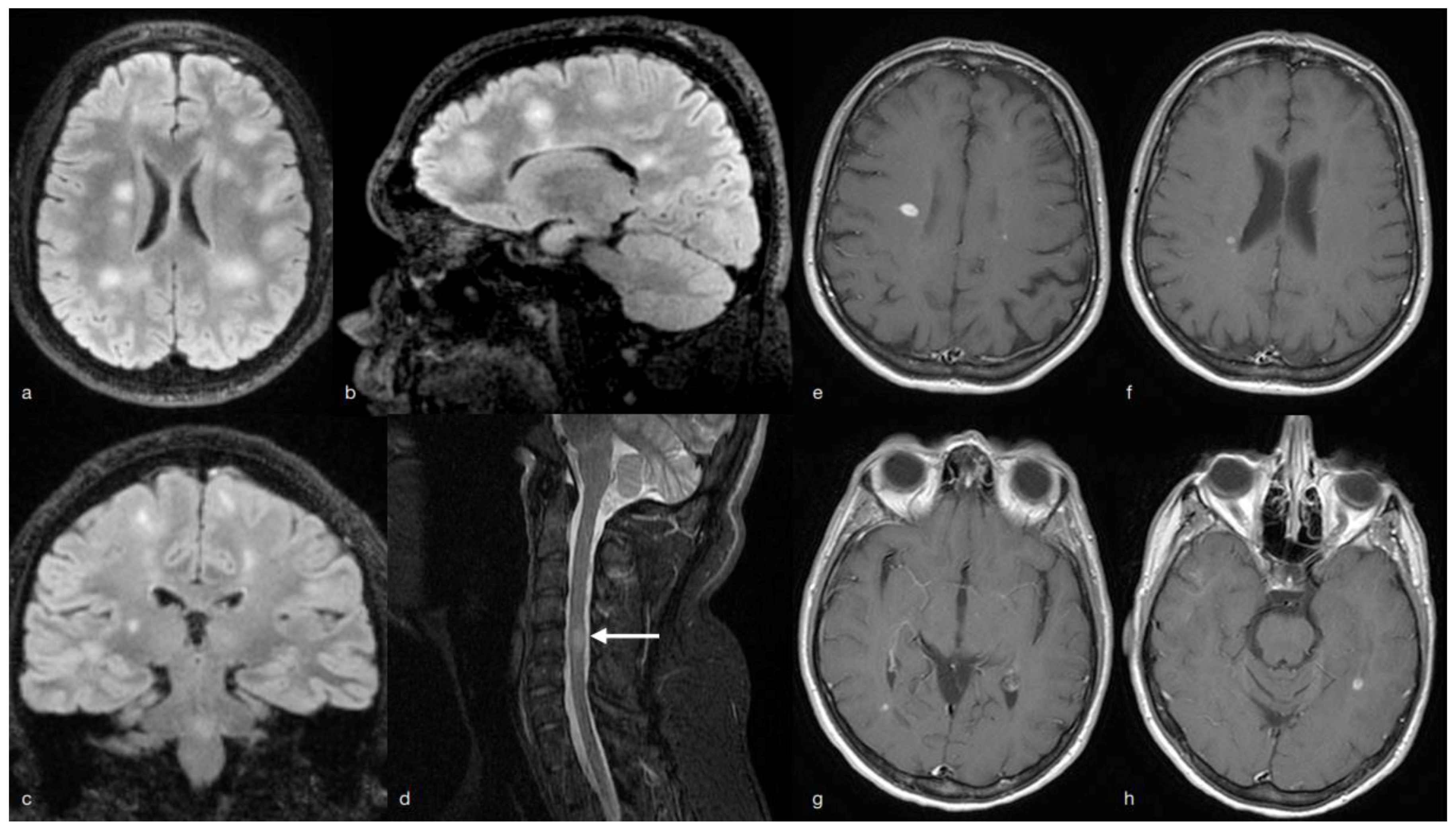 Neurolint 13 00066 g001 550