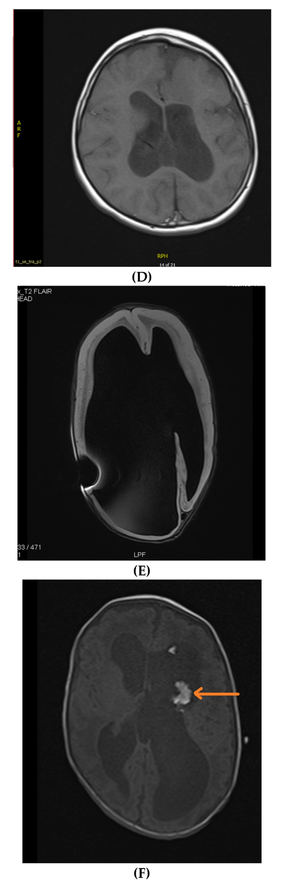 Neurolint 14 00021 g002b 550