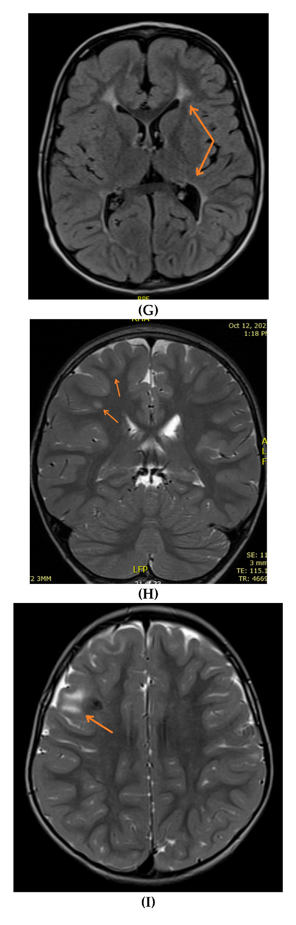 Neurolint 14 00021 g002c 550