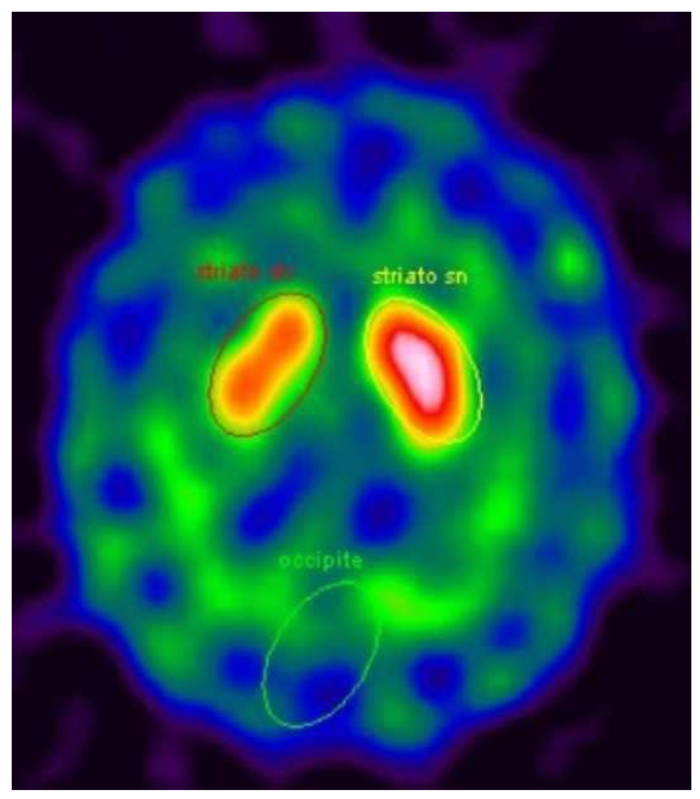 Neurolint 14 00055 g001 550