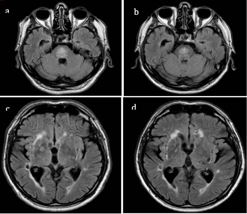 Neurolint 14 00055 g002 550