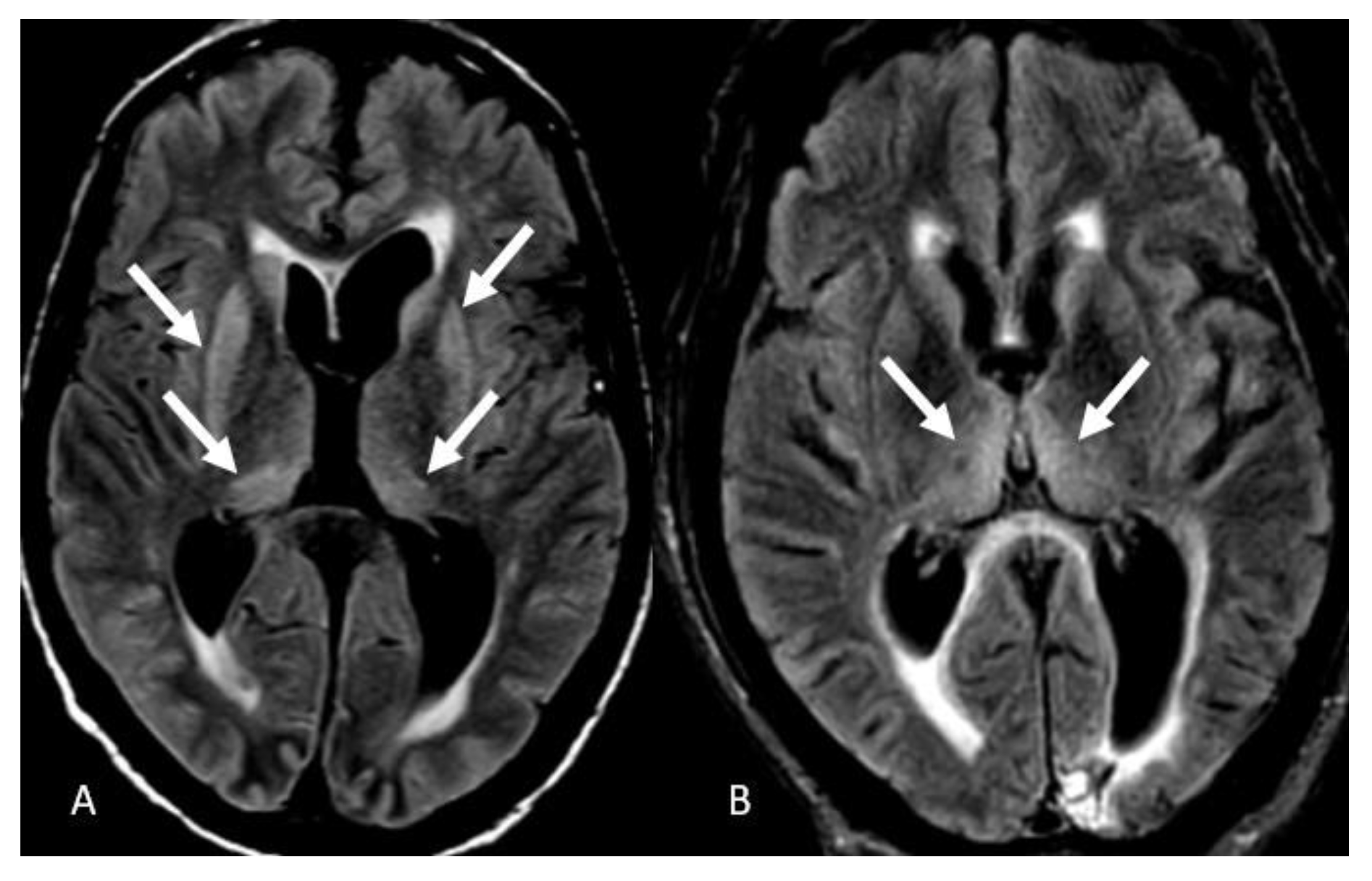 Neurolint 15 00005 g006 Neurolint 15 00005 g006