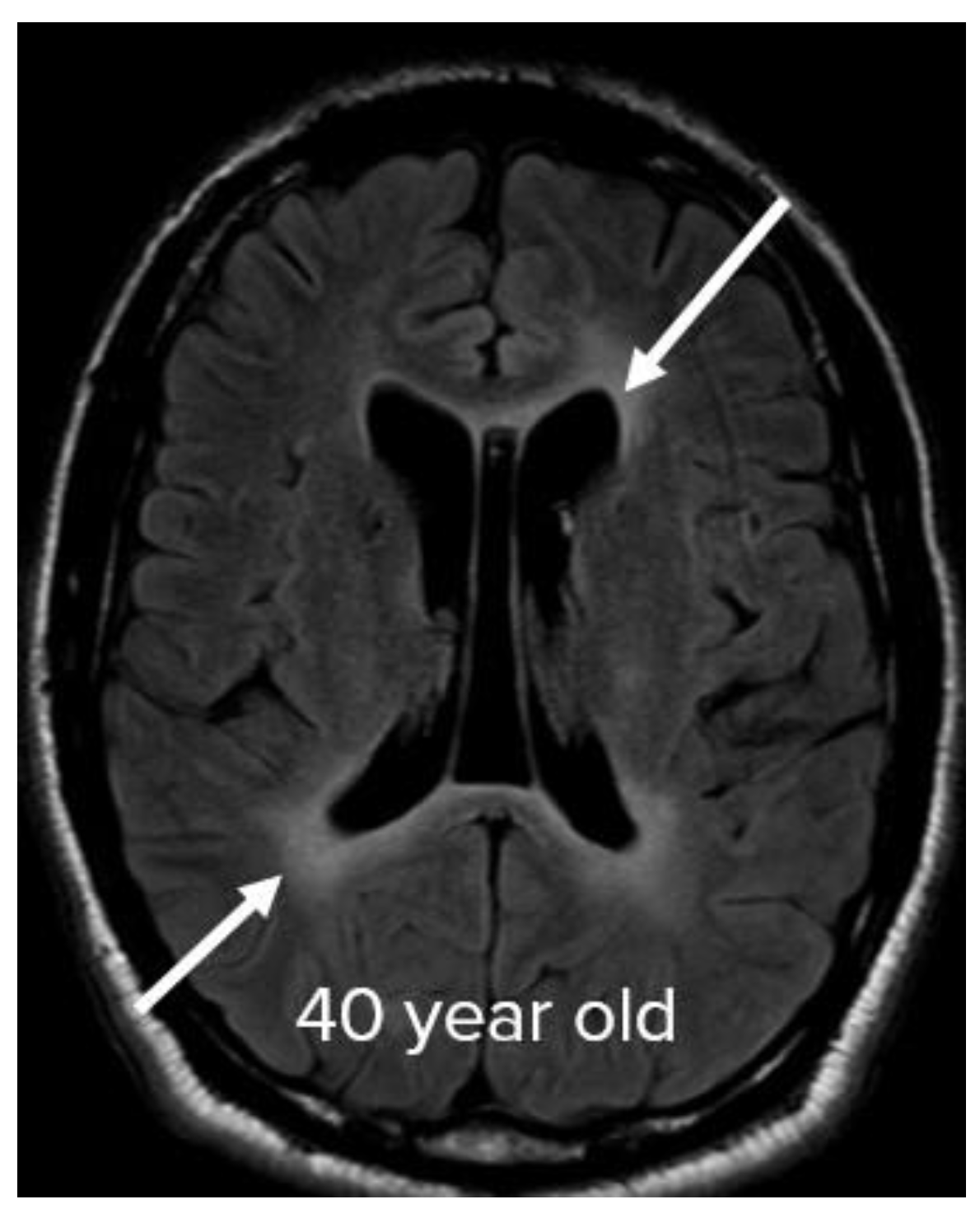 Neurolint 15 00005 g007 Neurolint 15 00005 g007