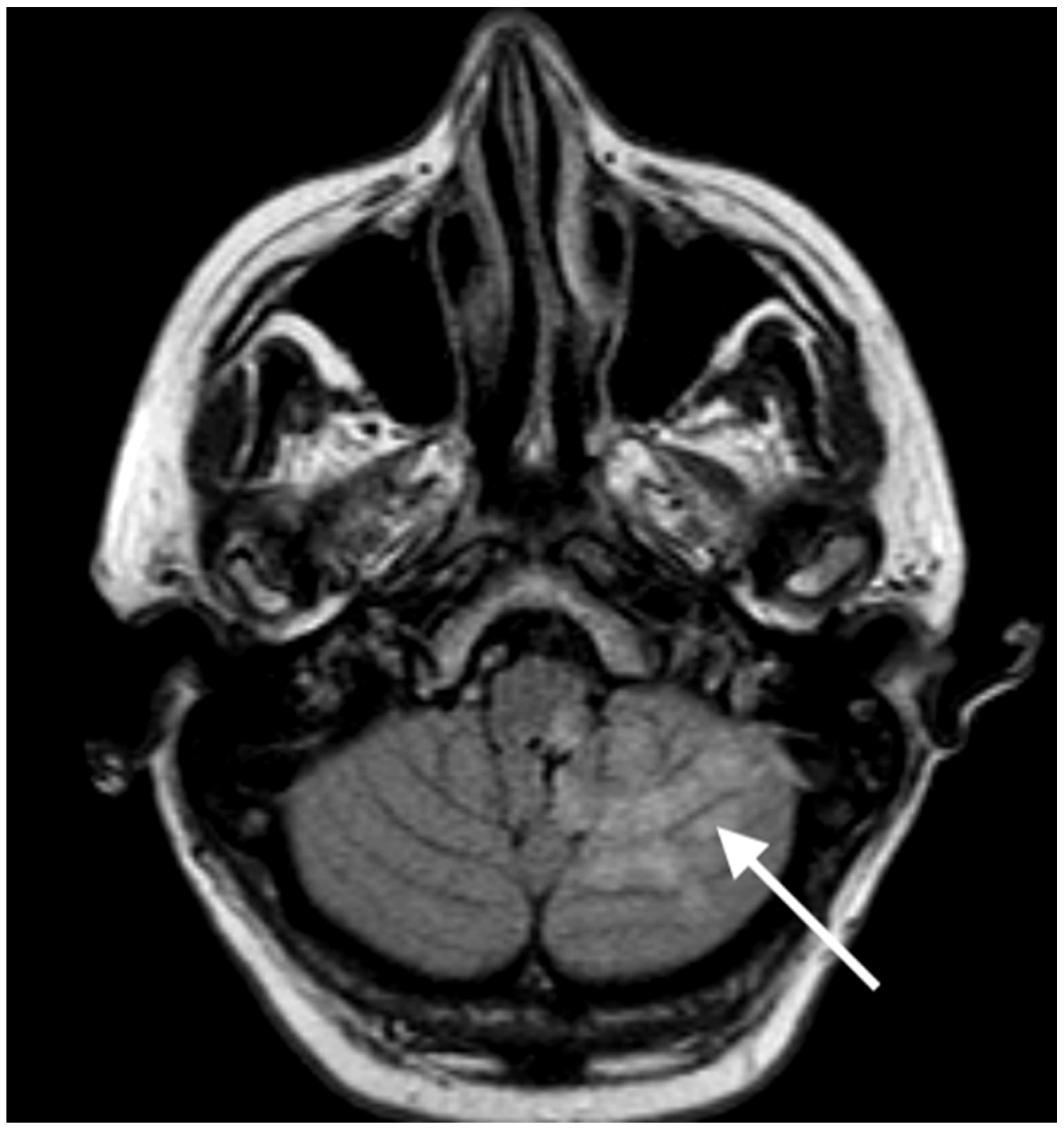 Neurolint 15 00074 g003