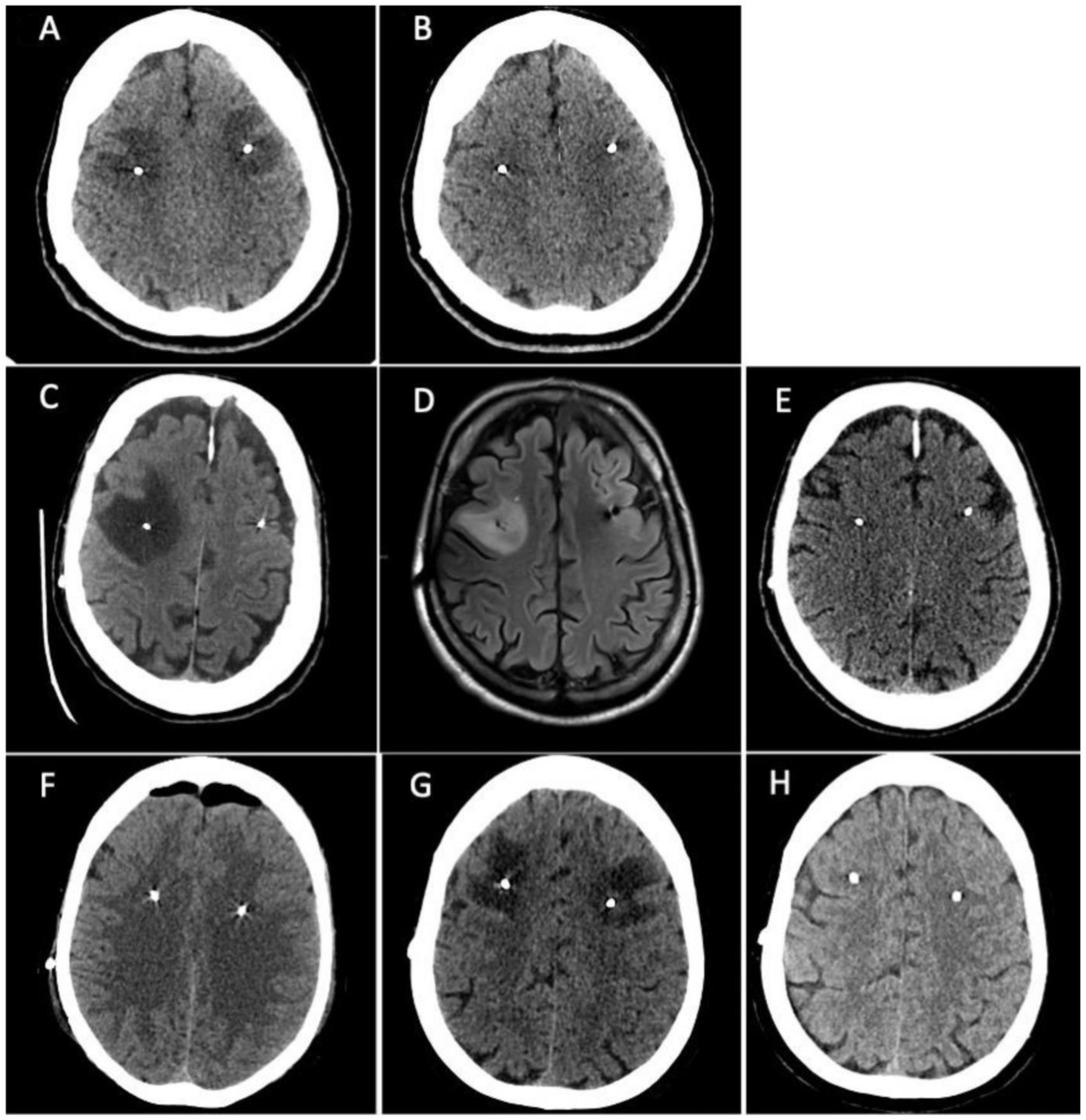 Neurolint 16 00004 g001