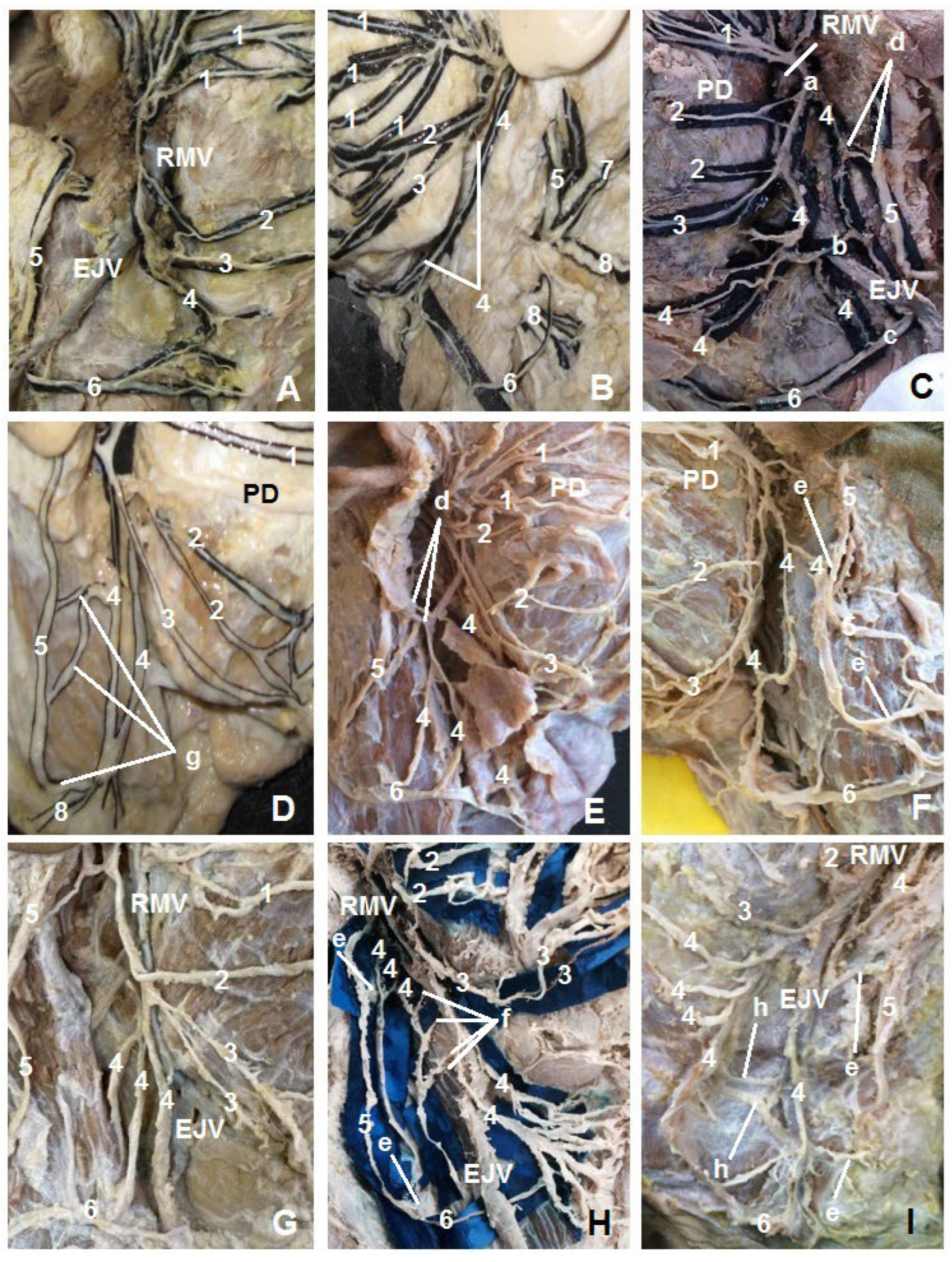 Neurolint 16 00007 g004