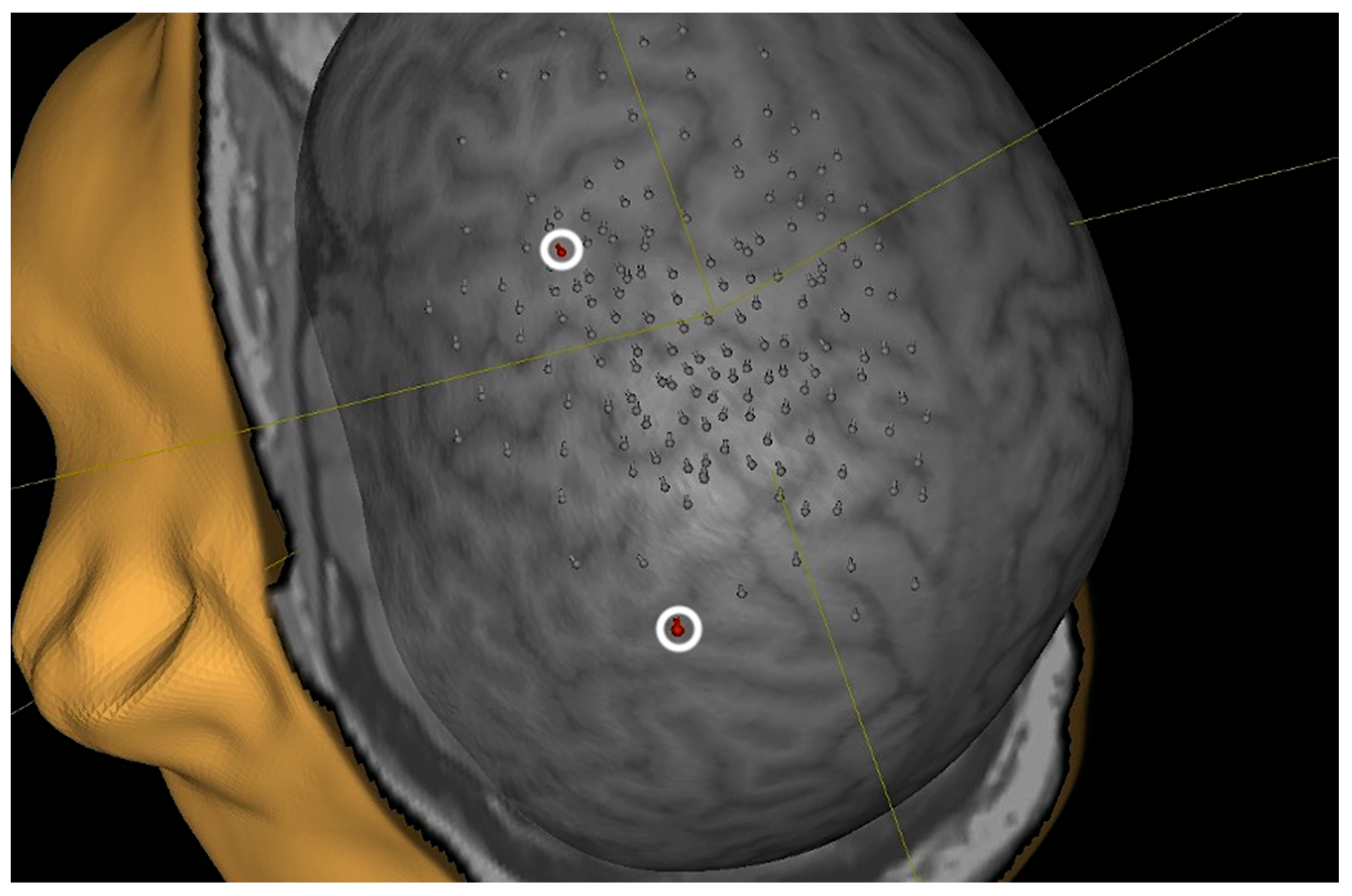 Neurolint 16 00016 g006