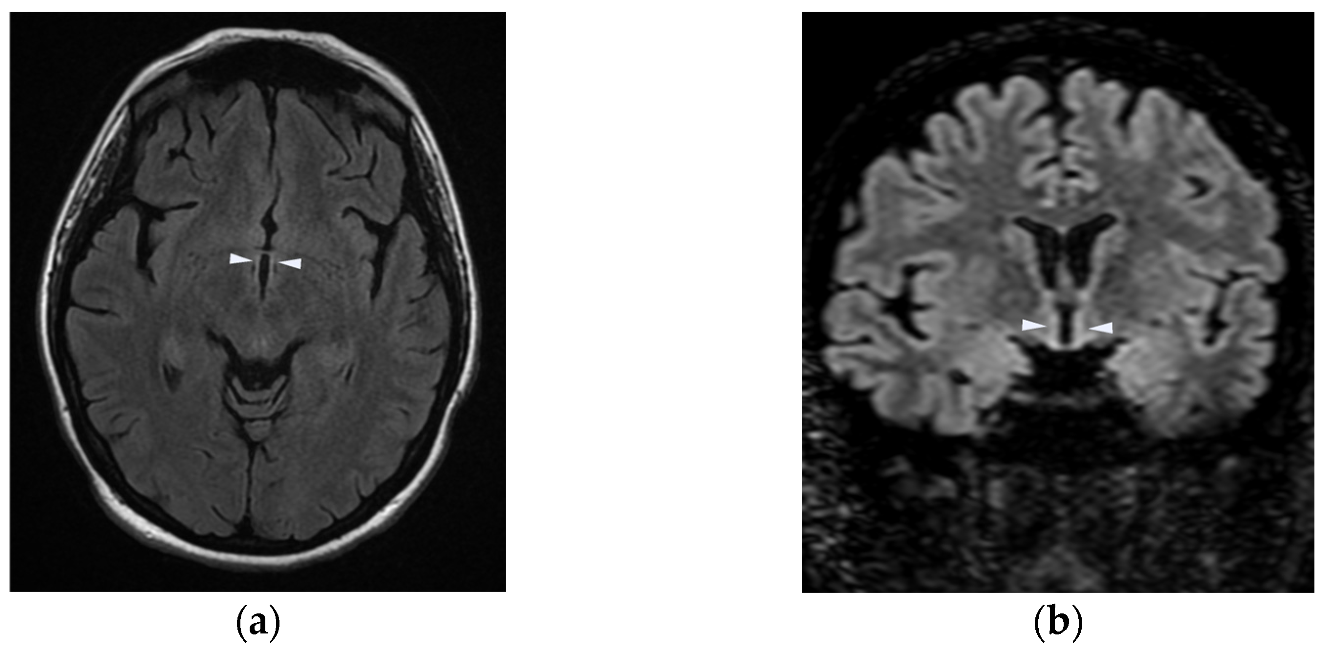 Neurolint 16 00018 g003