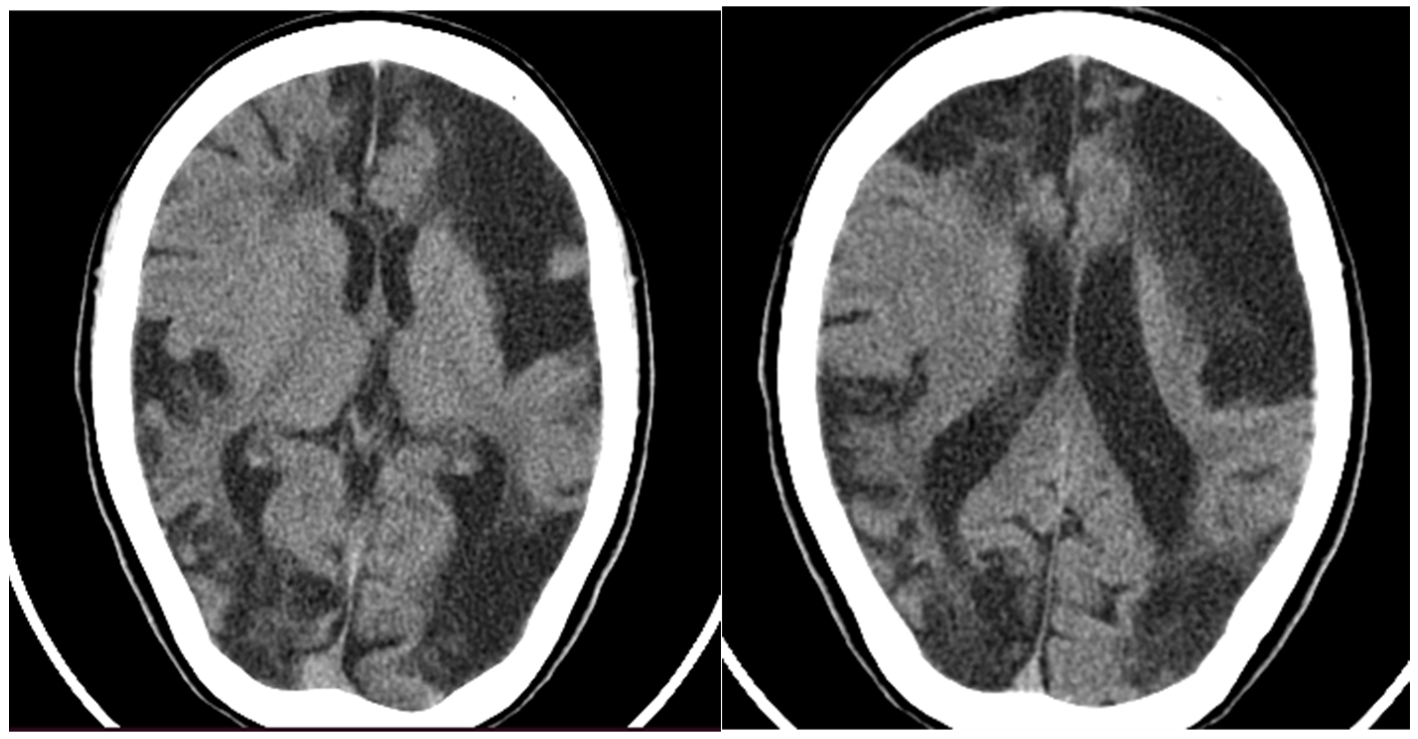 Neurolint 16 00065 g002