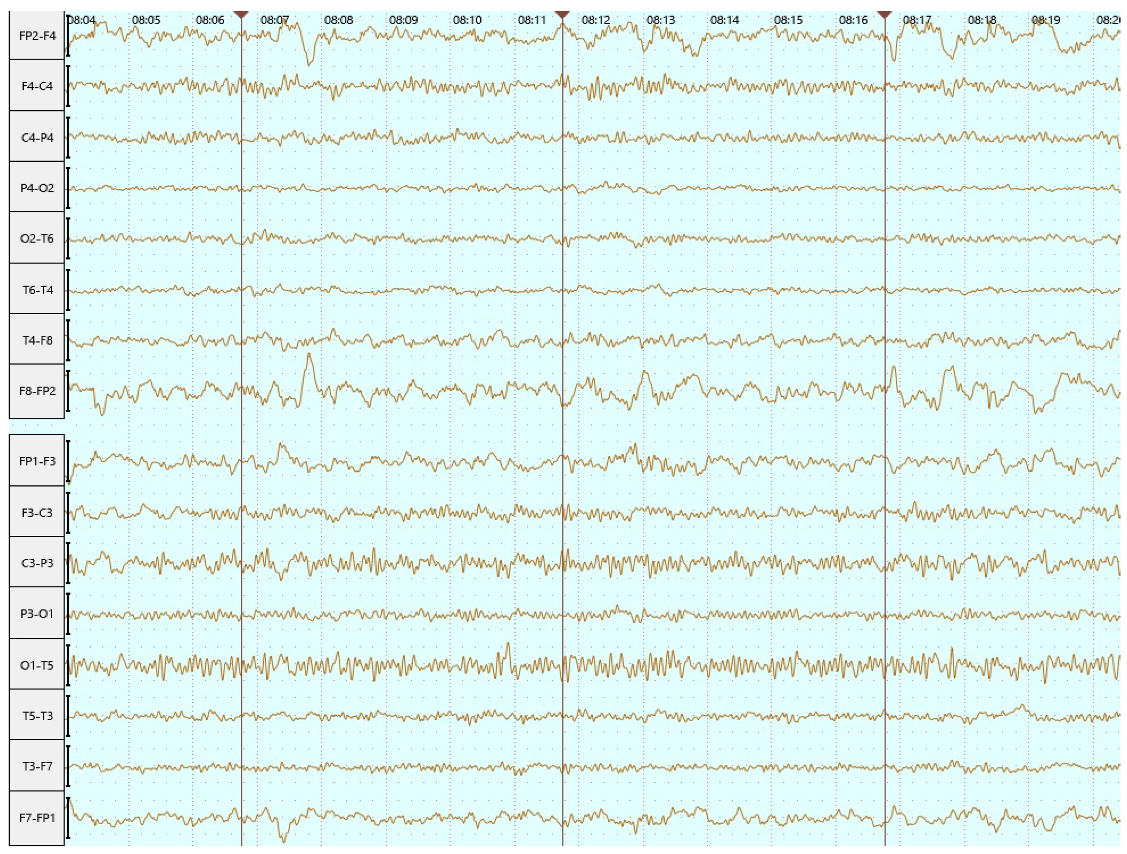 Neurolint 16 00065 g005