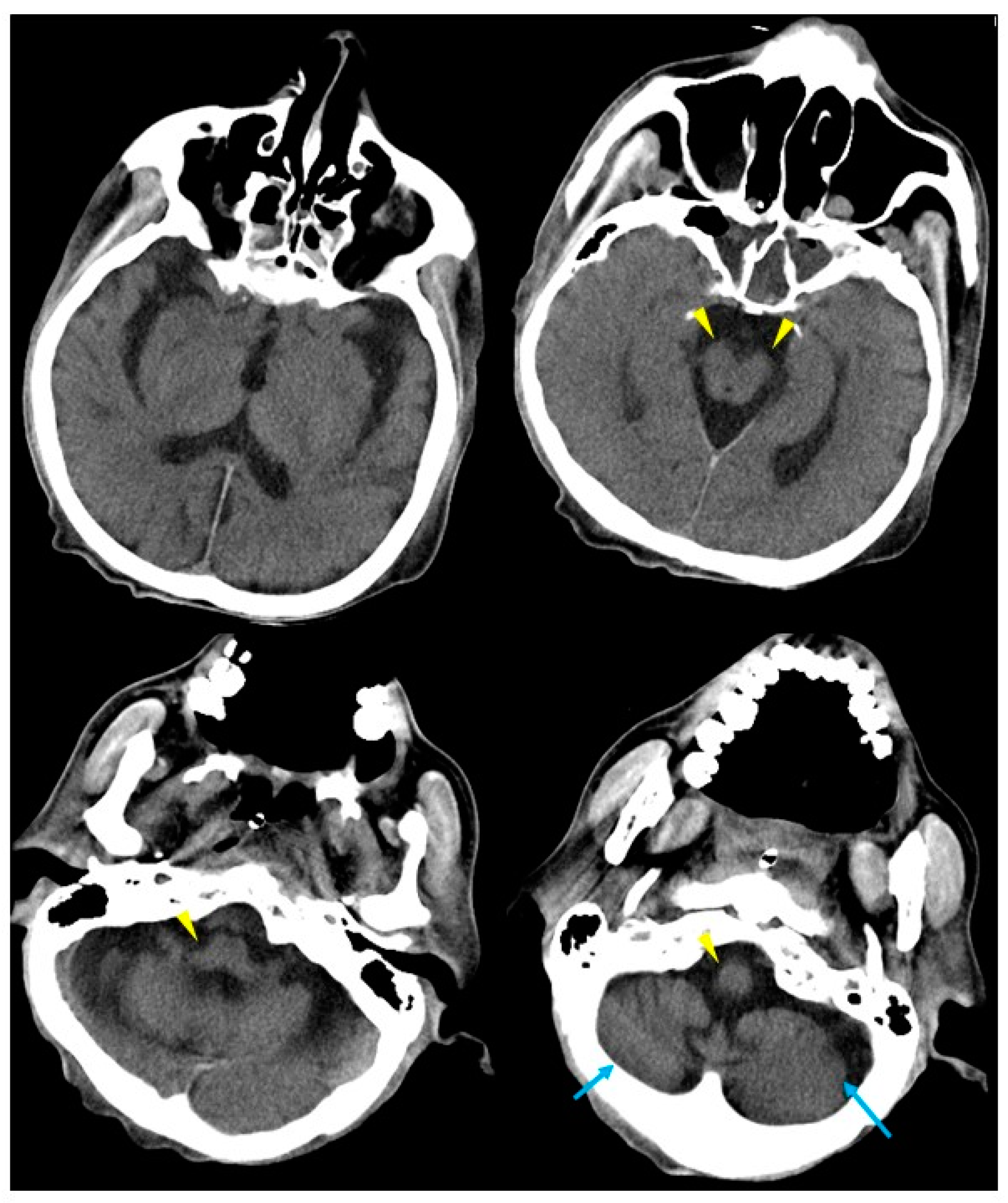 Neurolint 16 00085 g003