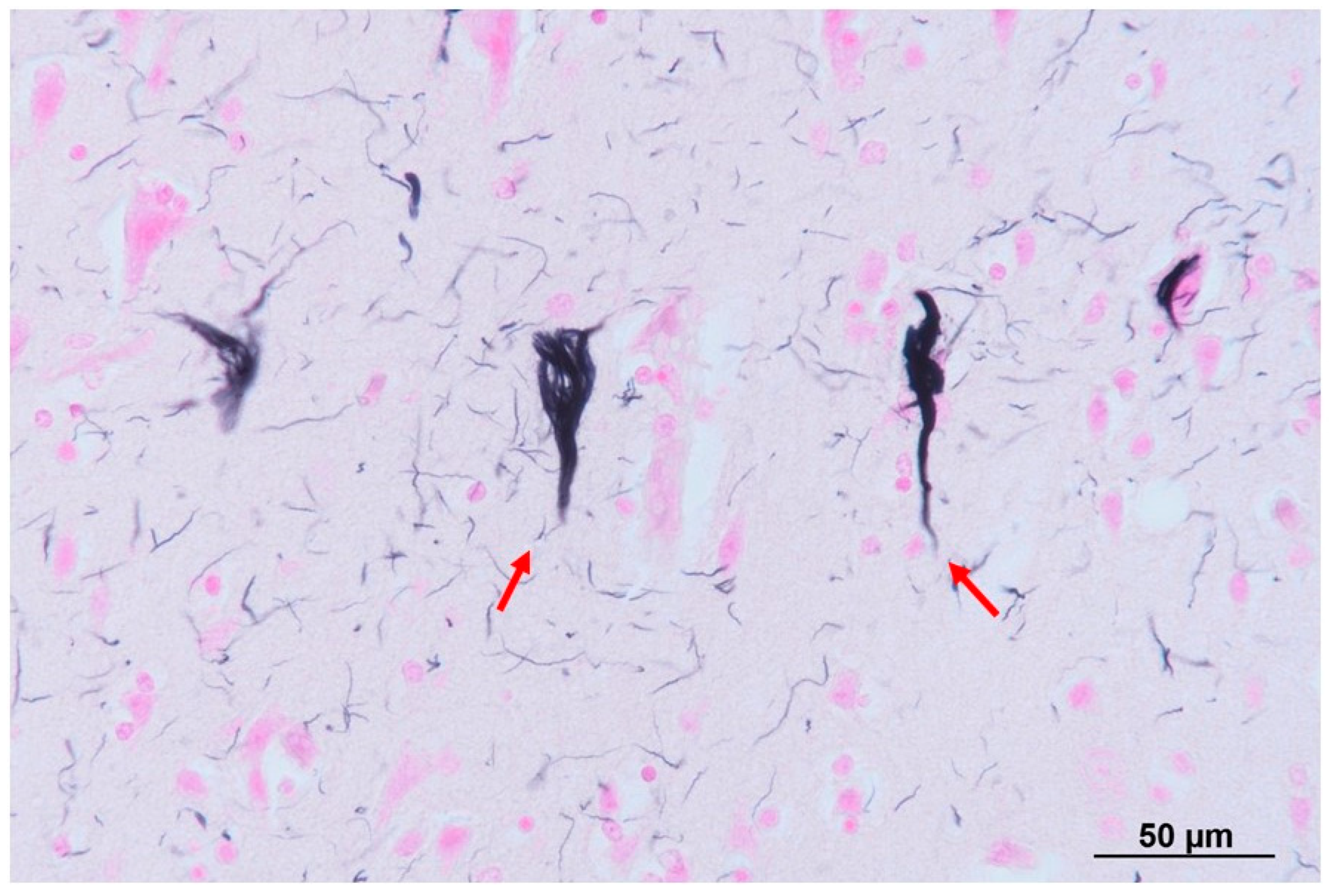 Neurolint 16 00085 g006