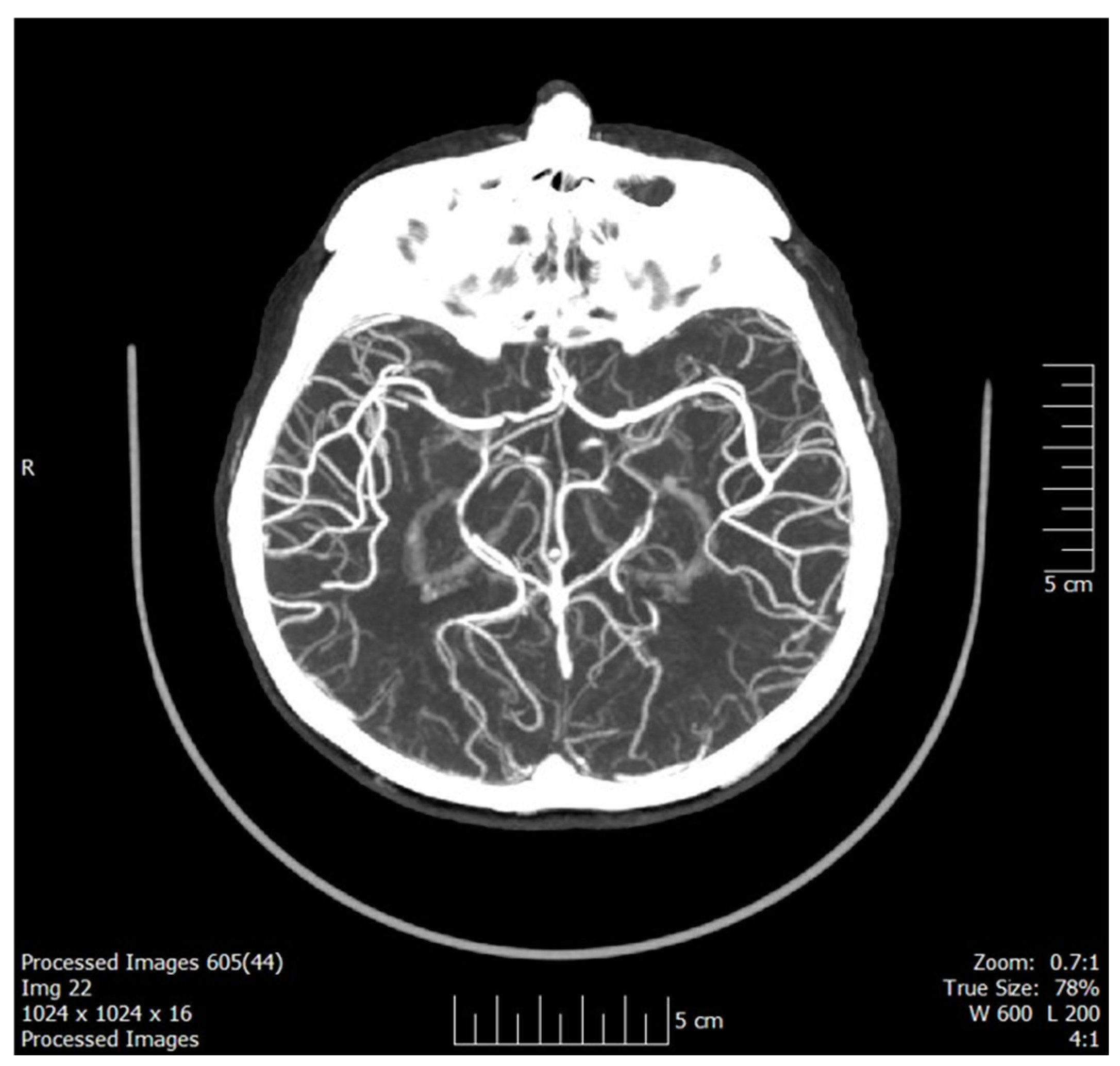 Neurolint 17 00003 g001