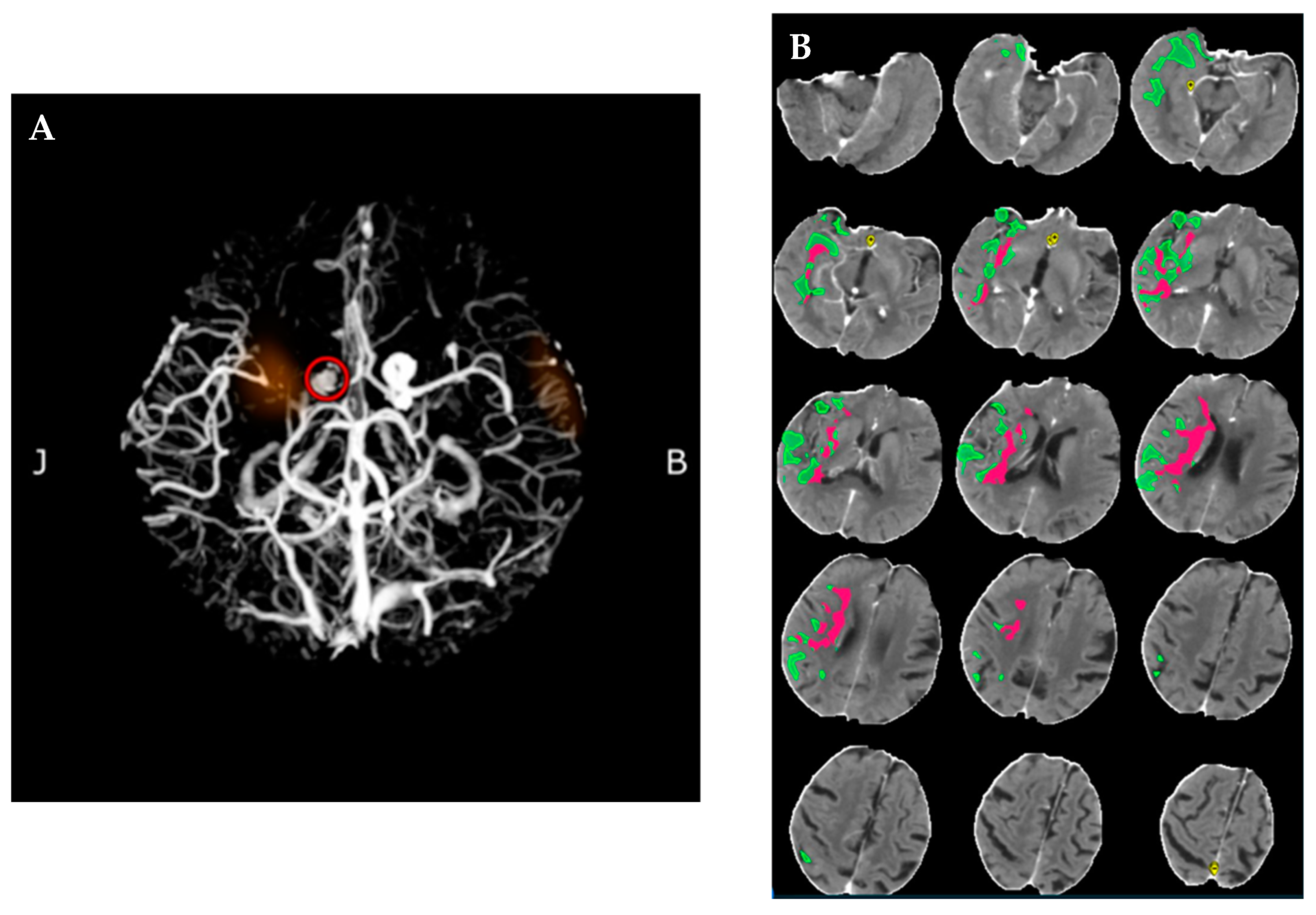 Neurolint 17 00003 g002