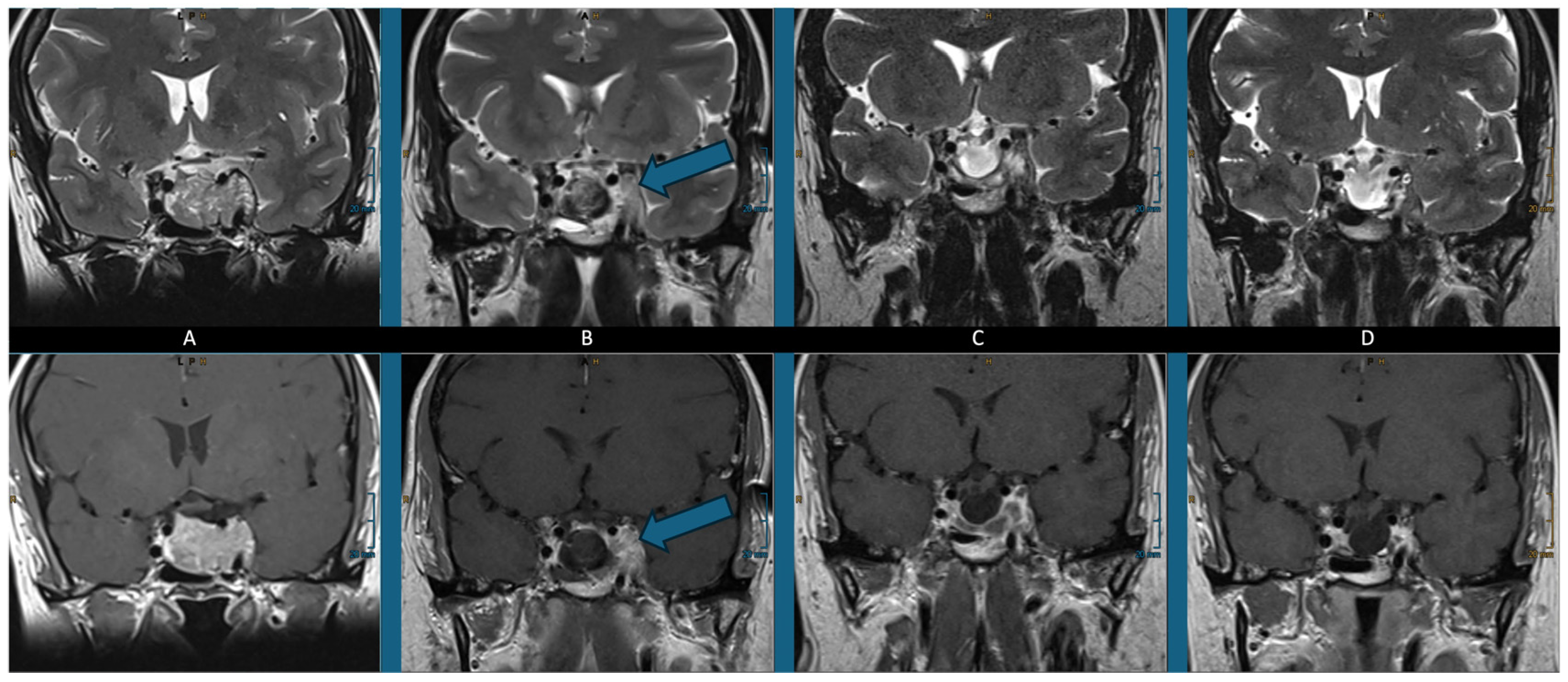 Neurolint 17 00005 g003
