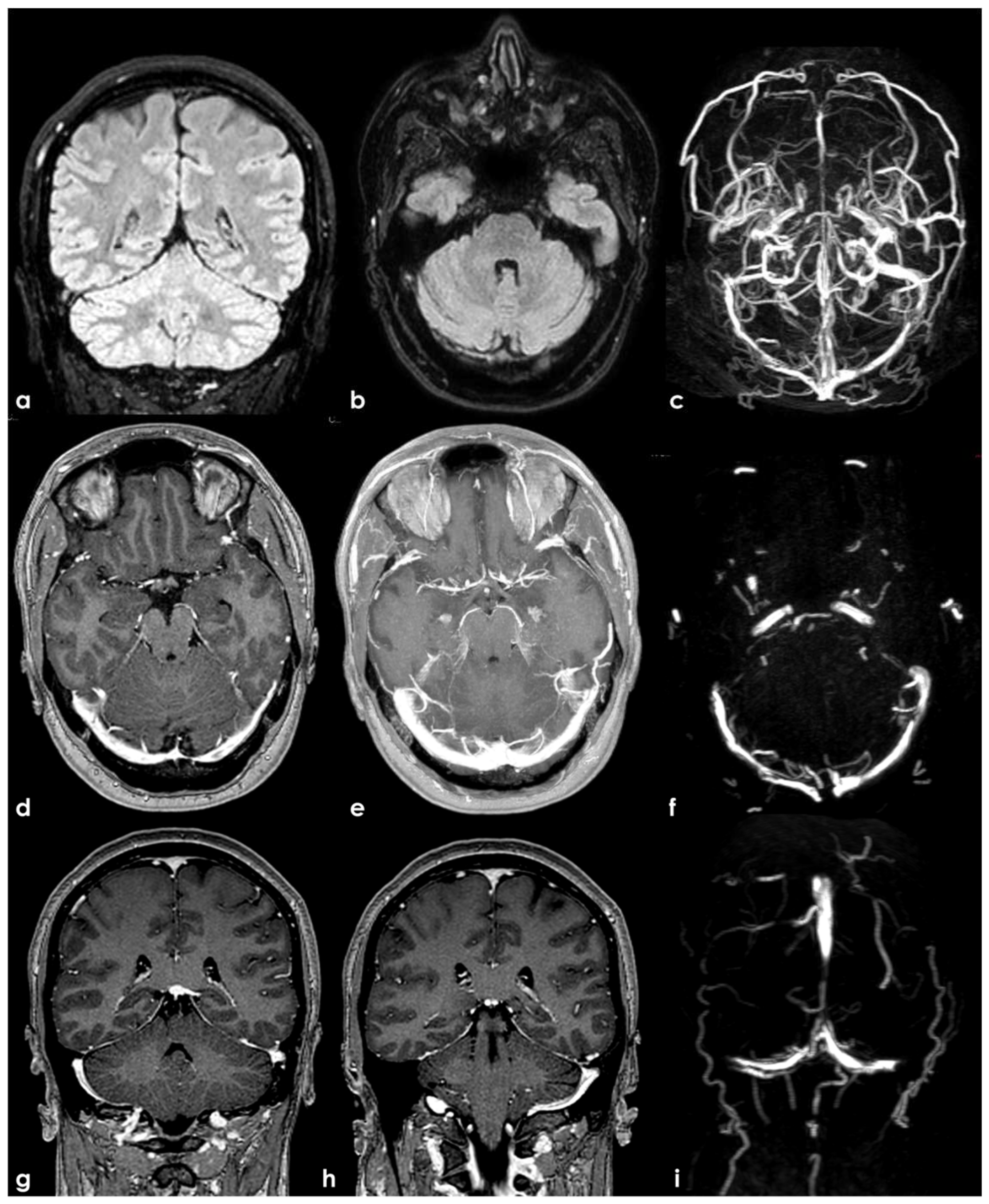 Neurolint 17 00009 g001 Neurolint 17 00009 g001