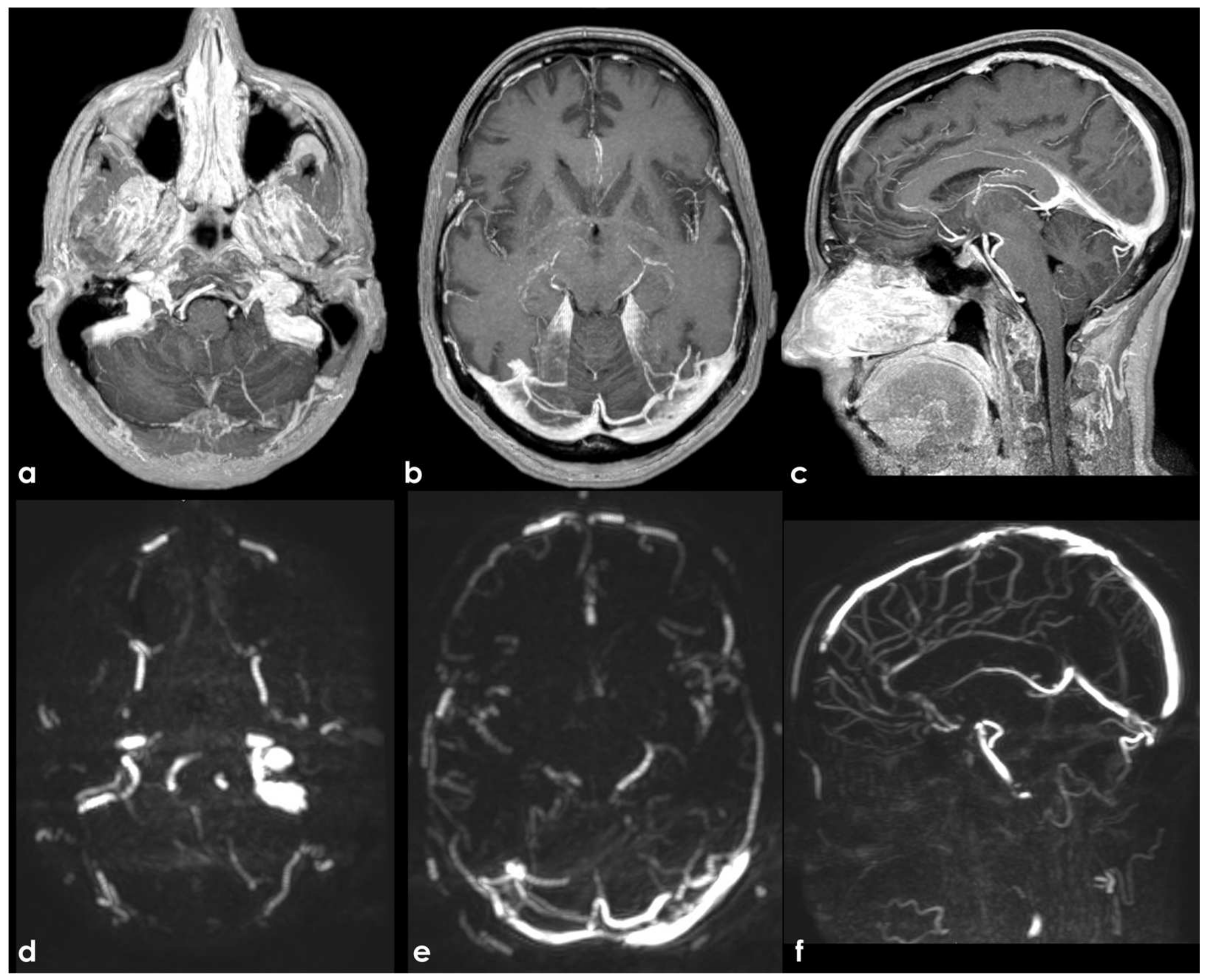 Neurolint 17 00009 g002 Neurolint 17 00009 g002