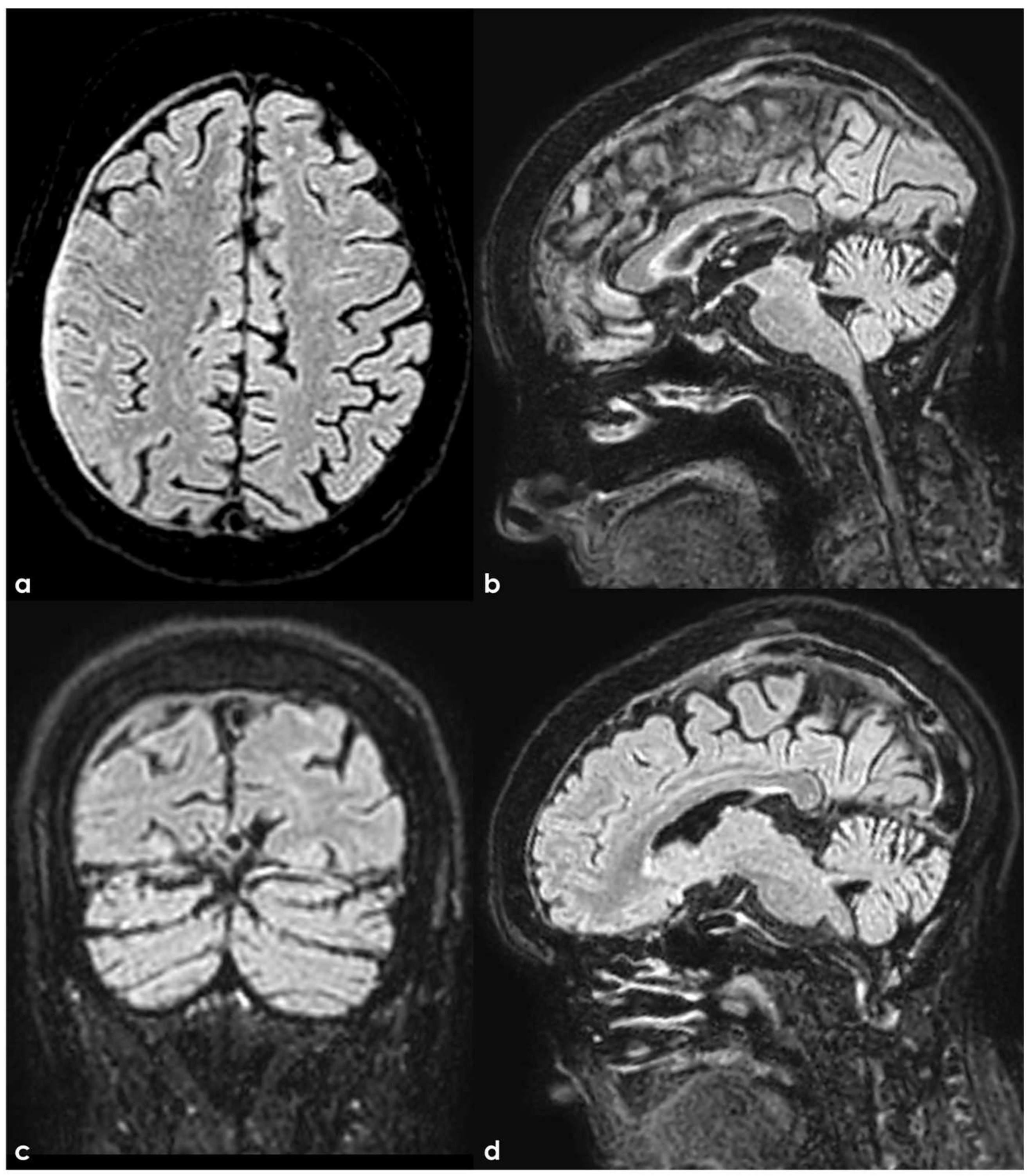 Neurolint 17 00009 g003 Neurolint 17 00009 g003