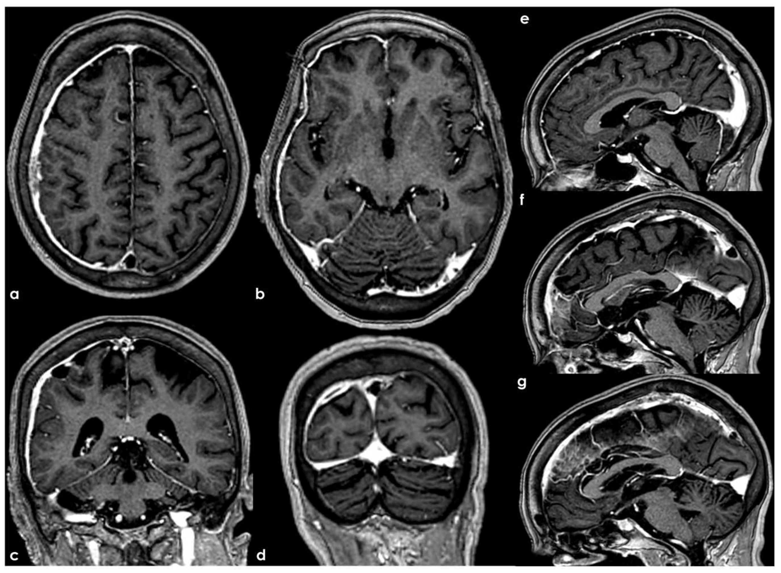 Neurolint 17 00009 g004 Neurolint 17 00009 g004