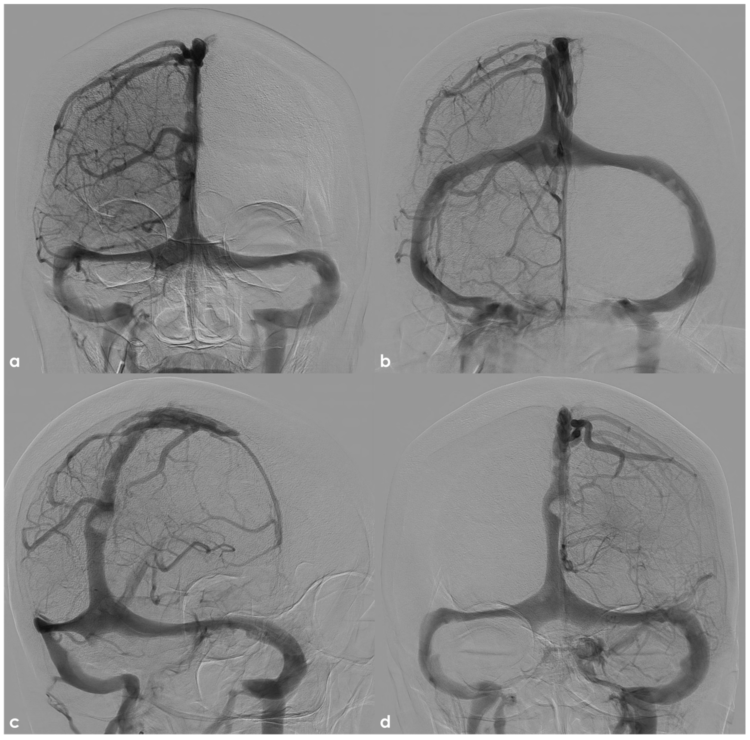 Neurolint 17 00009 g005 Neurolint 17 00009 g005