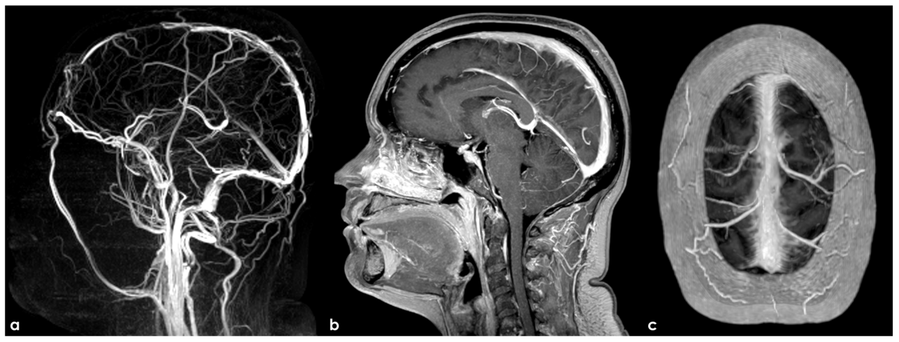 Neurolint 17 00009 g008 Neurolint 17 00009 g008