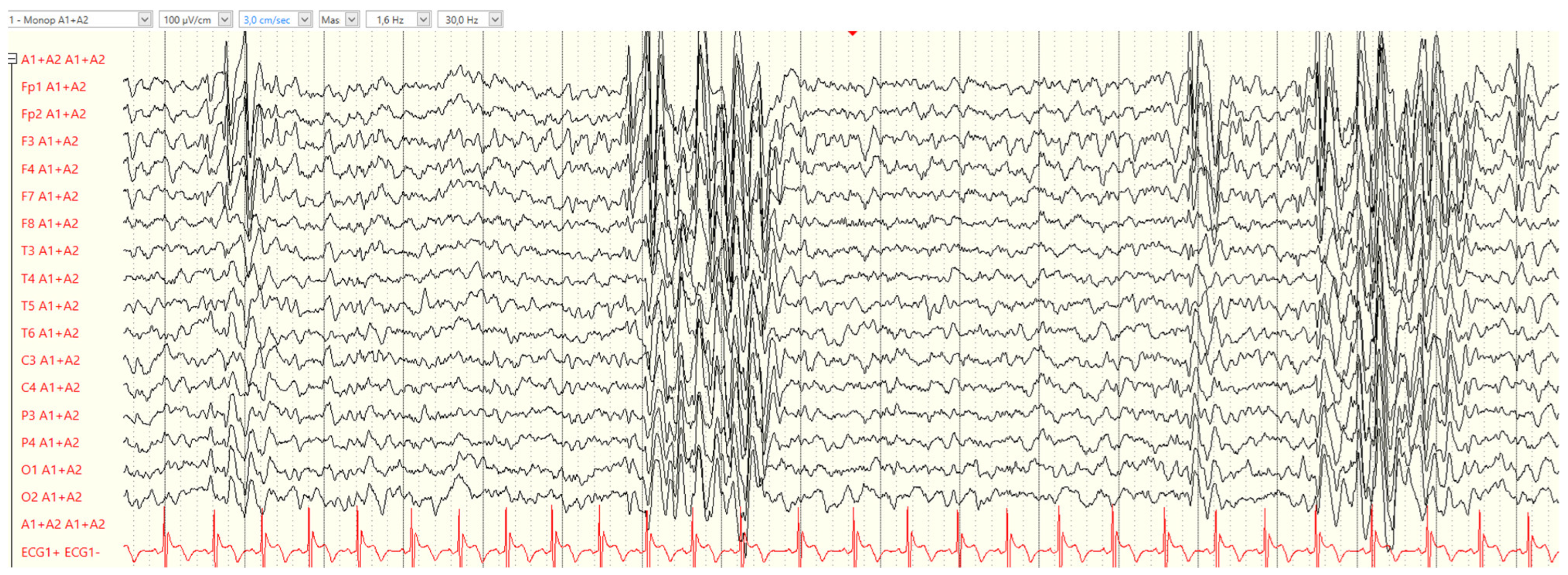 Neurolint 17 00014 g002