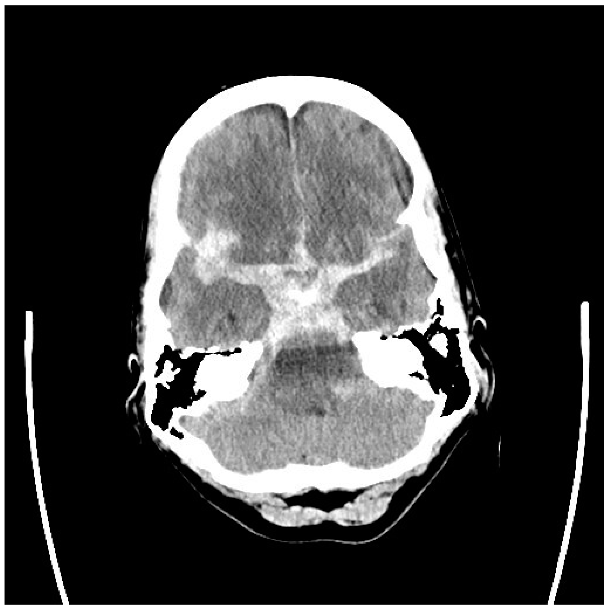Neurolint 17 00036 g001