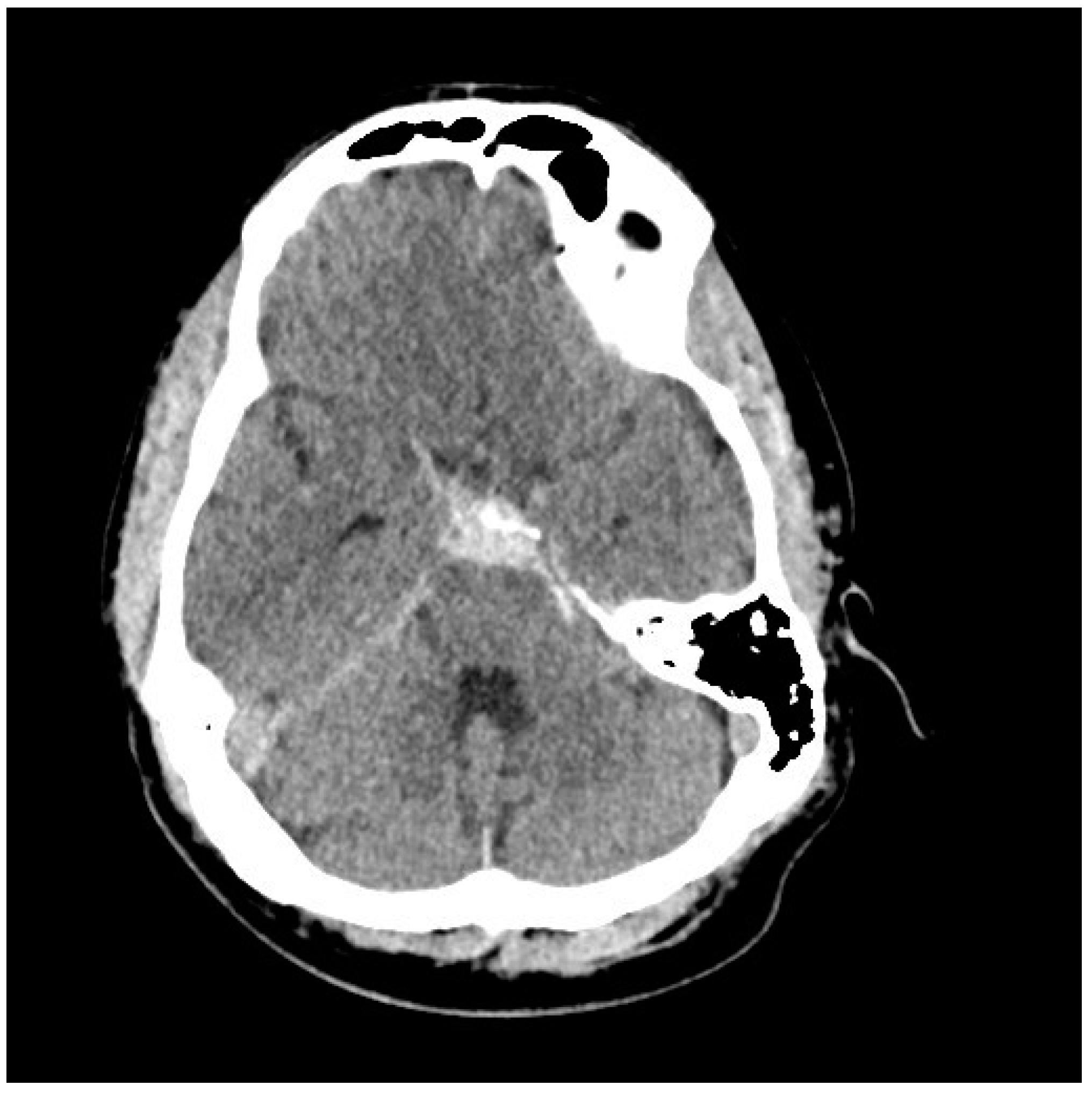 Neurolint 17 00036 g004