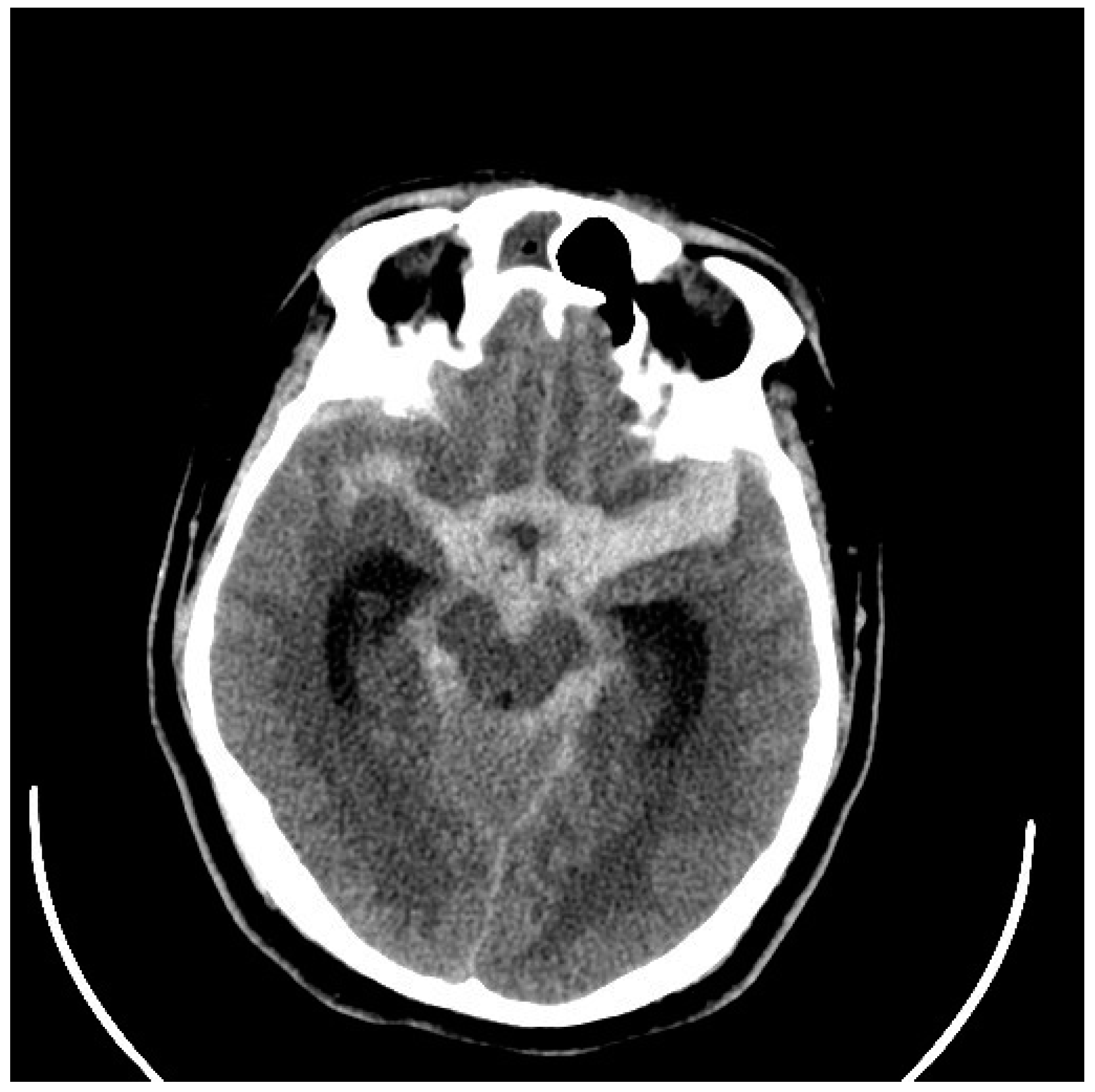 Neurolint 17 00036 g005