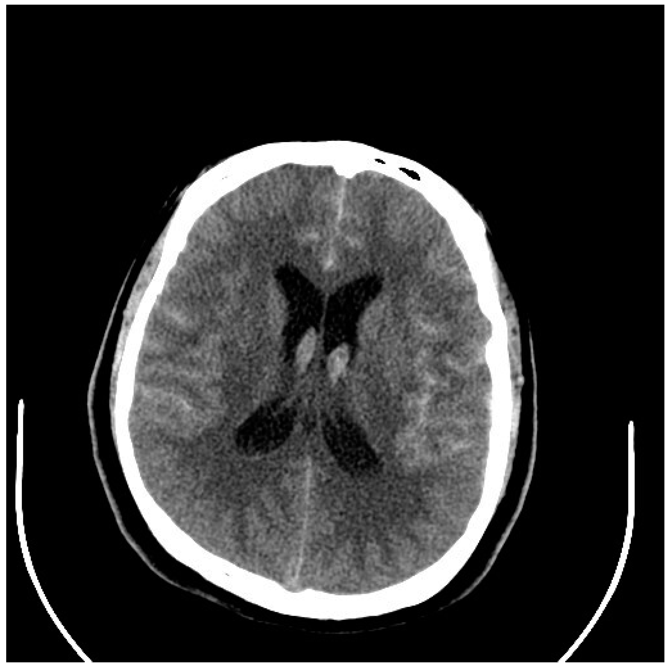 Neurolint 17 00036 g006