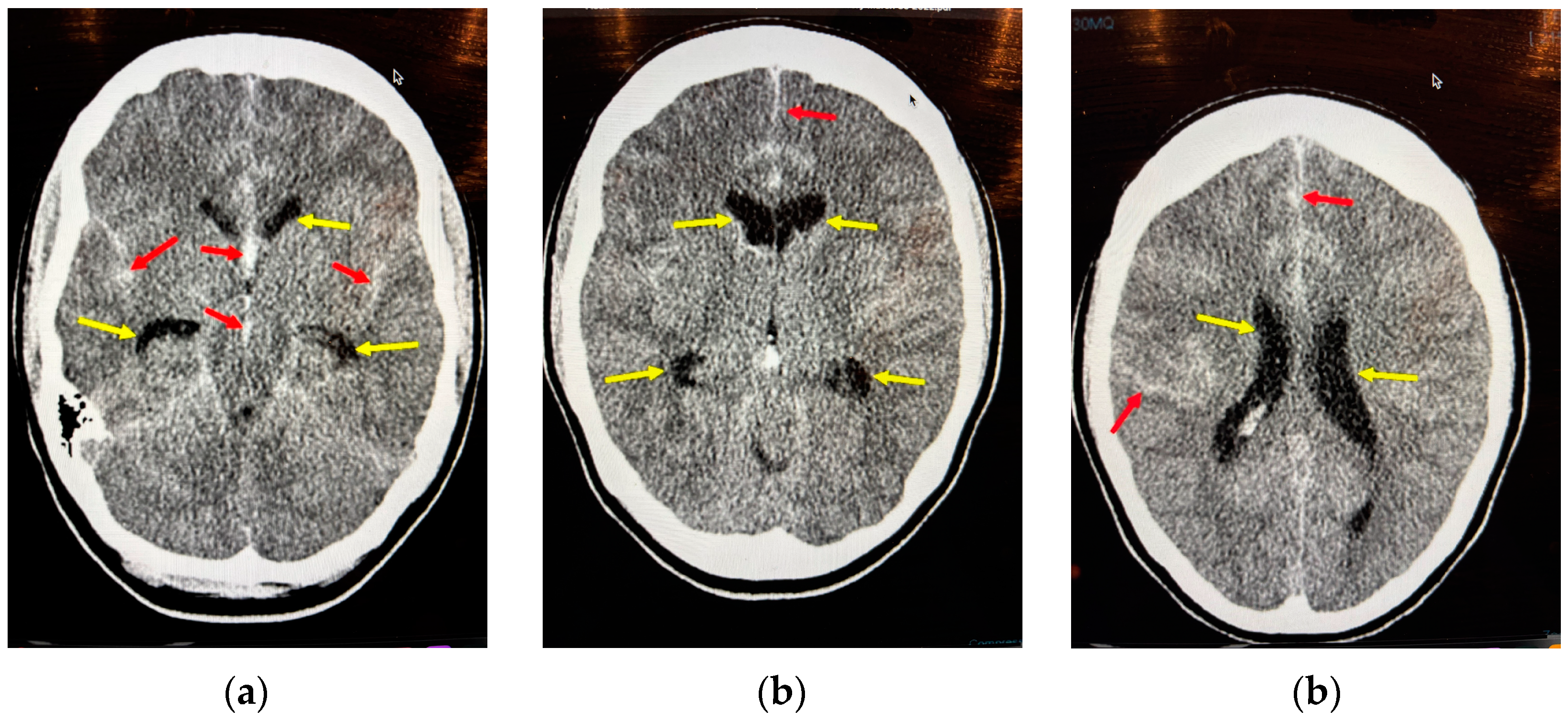 Neurolint 17 00036 g010