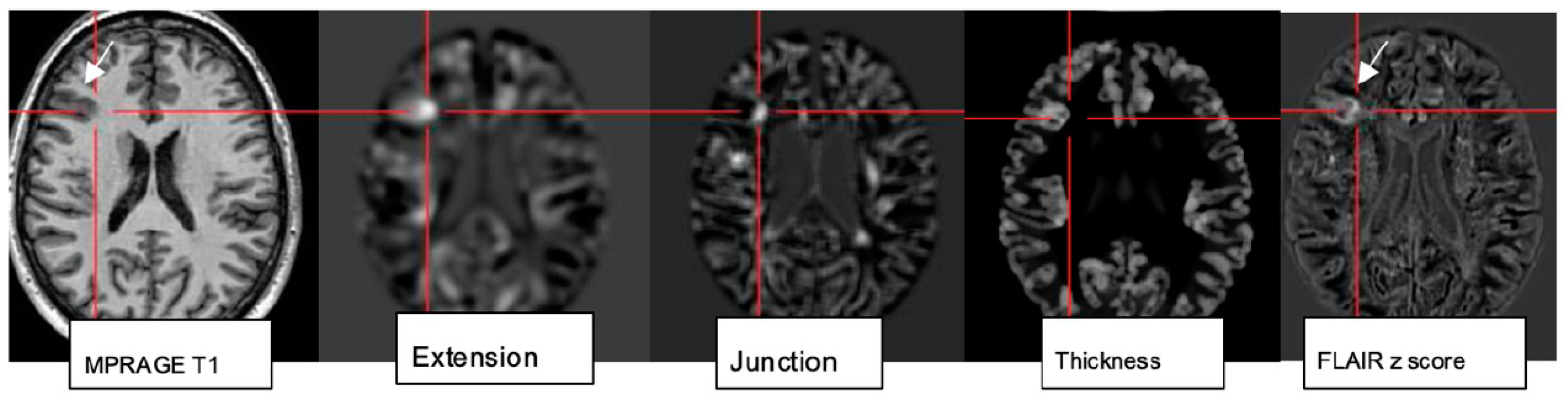 Neurolint 17 00066 g006