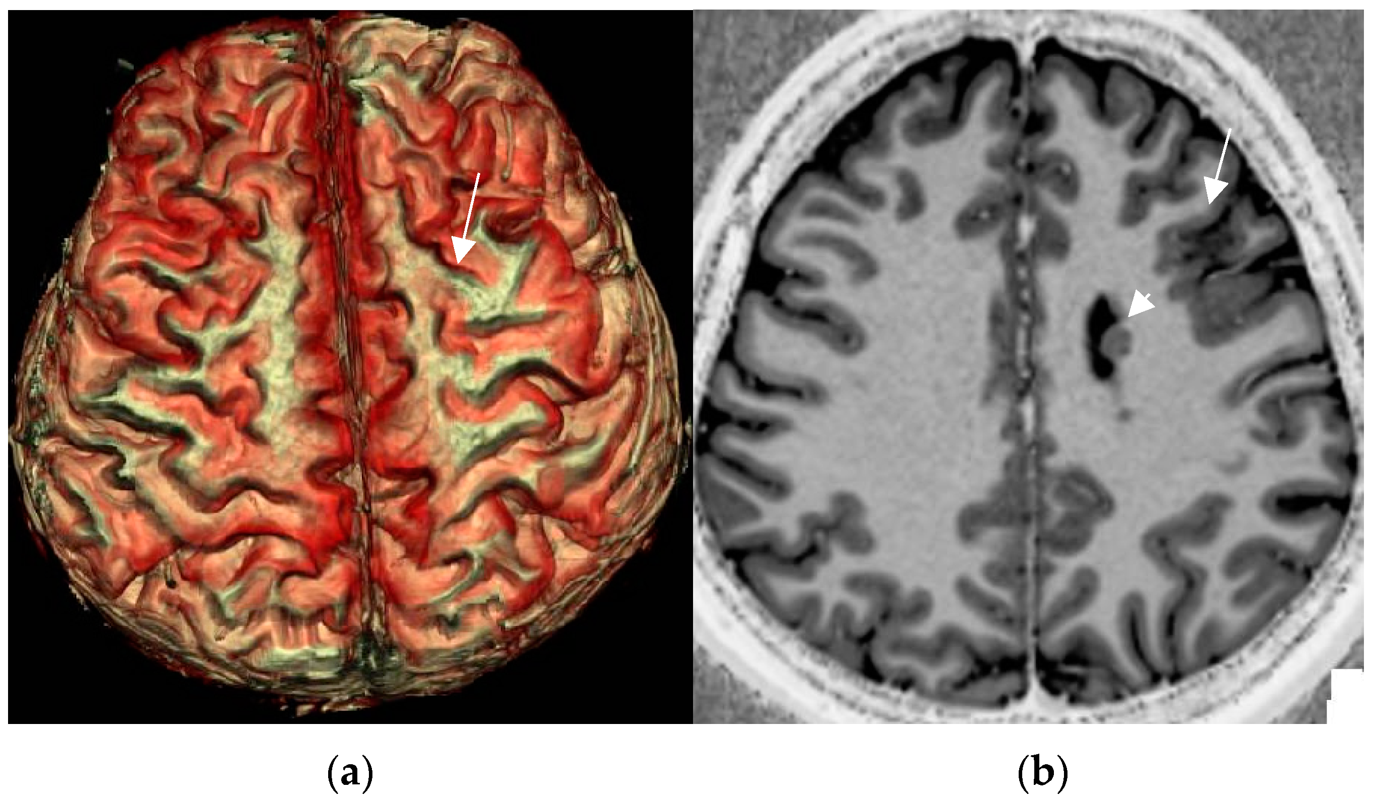 Neurolint 17 00066 g008